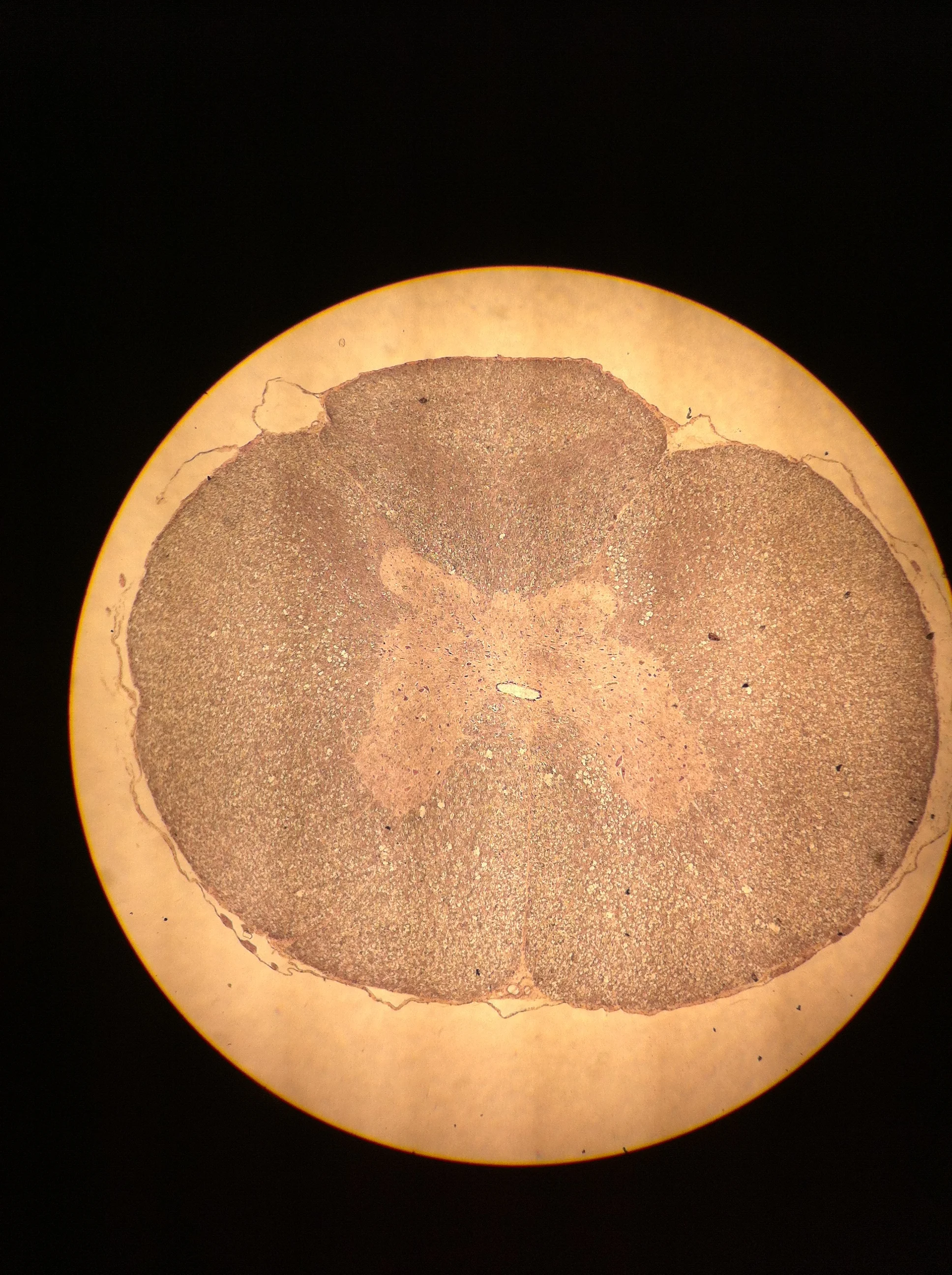 Thoracic Spine 40X