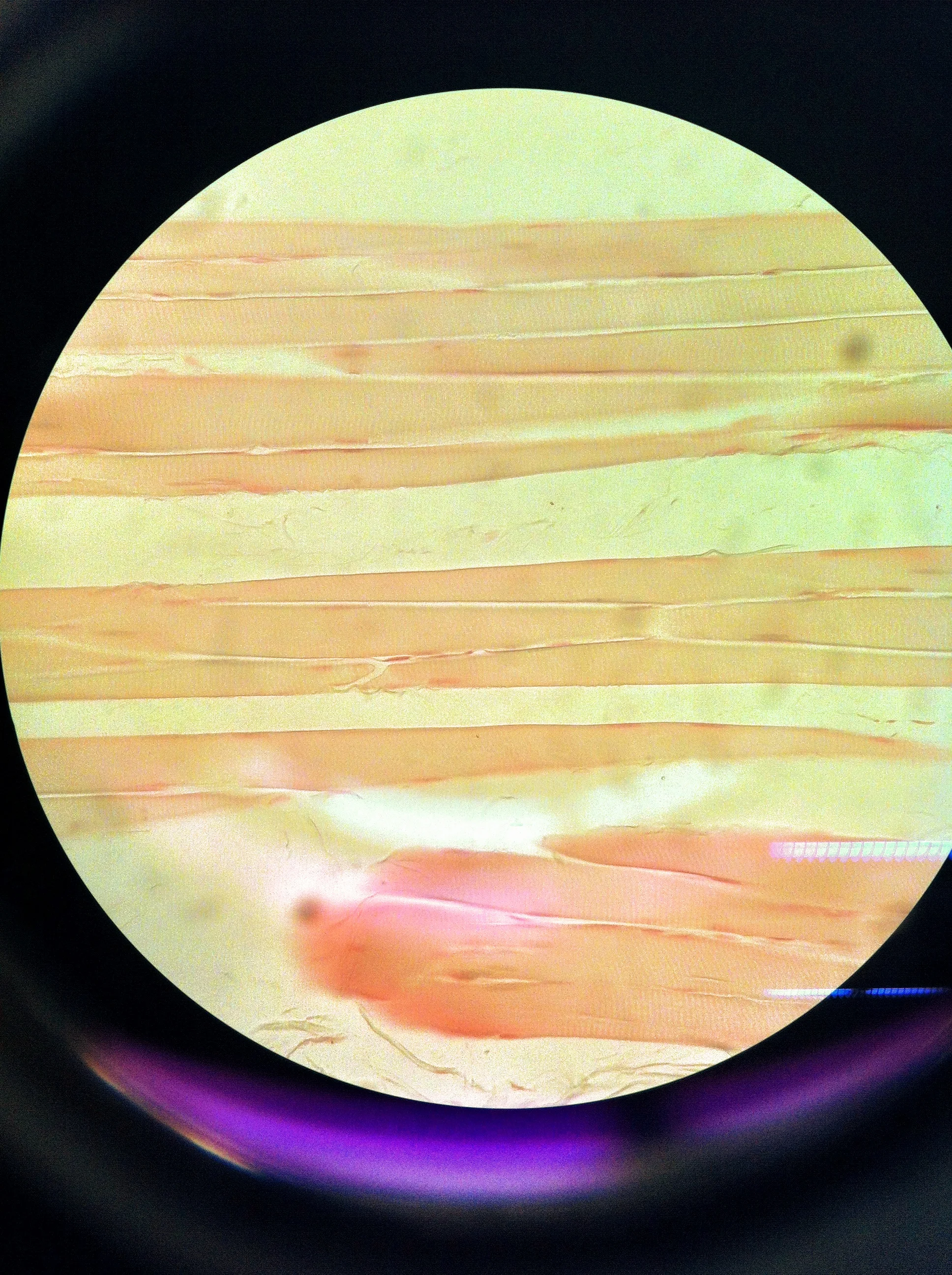 skeletal muscle 400X