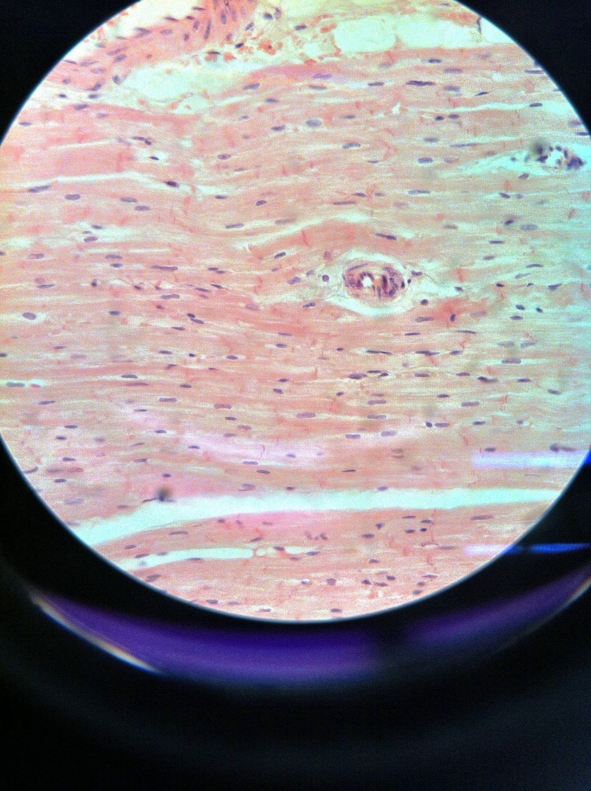 Cardiac Muscle 400X