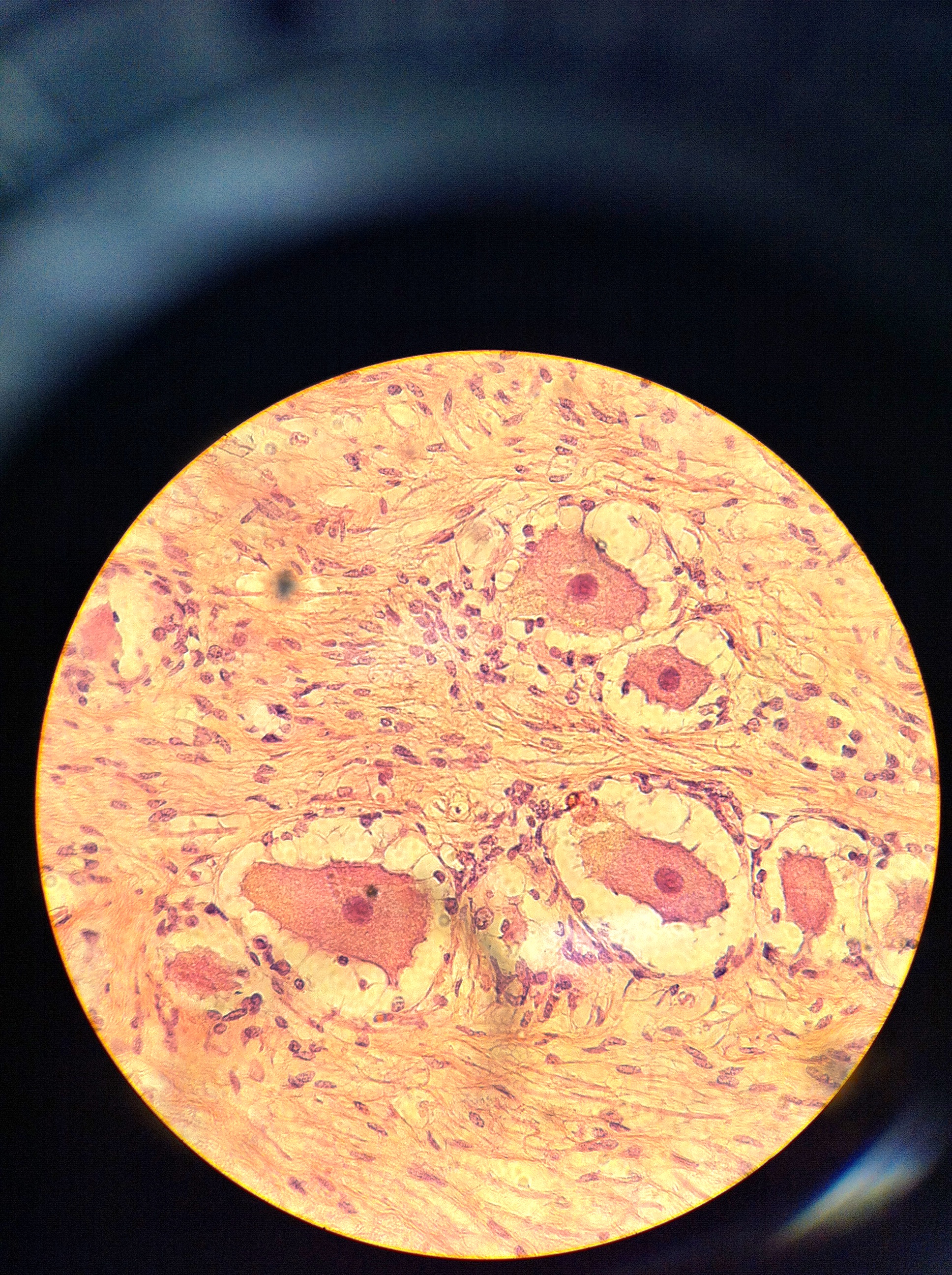 Dorsal Root Ganglion 400X