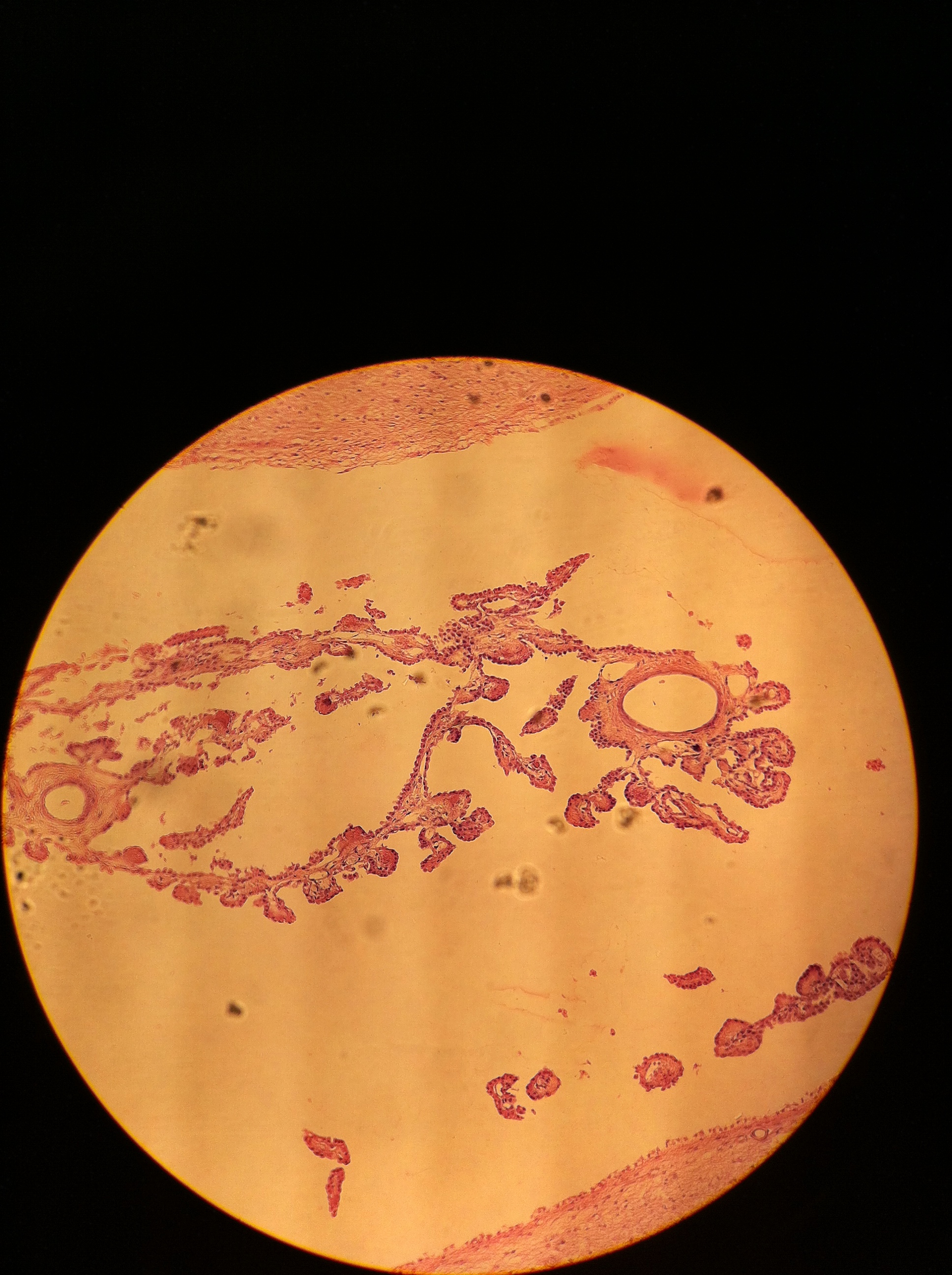 Ependymal Cells 100X