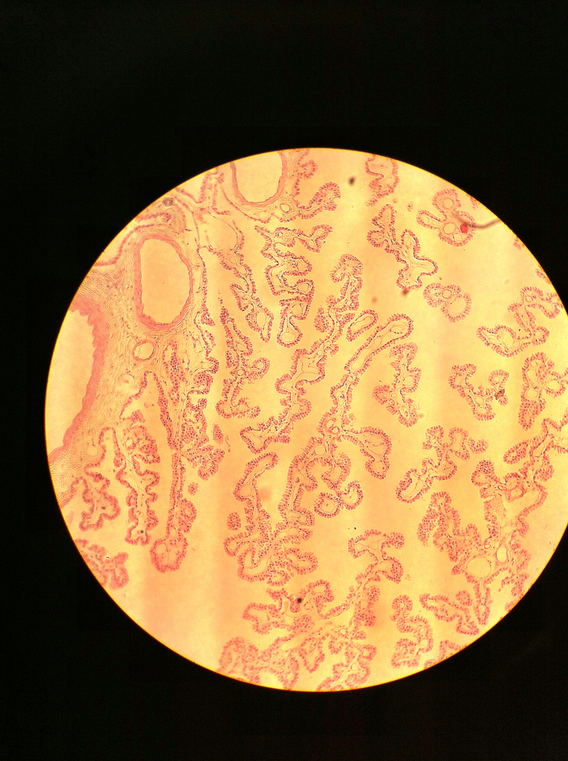 Ependymal Cells 100X