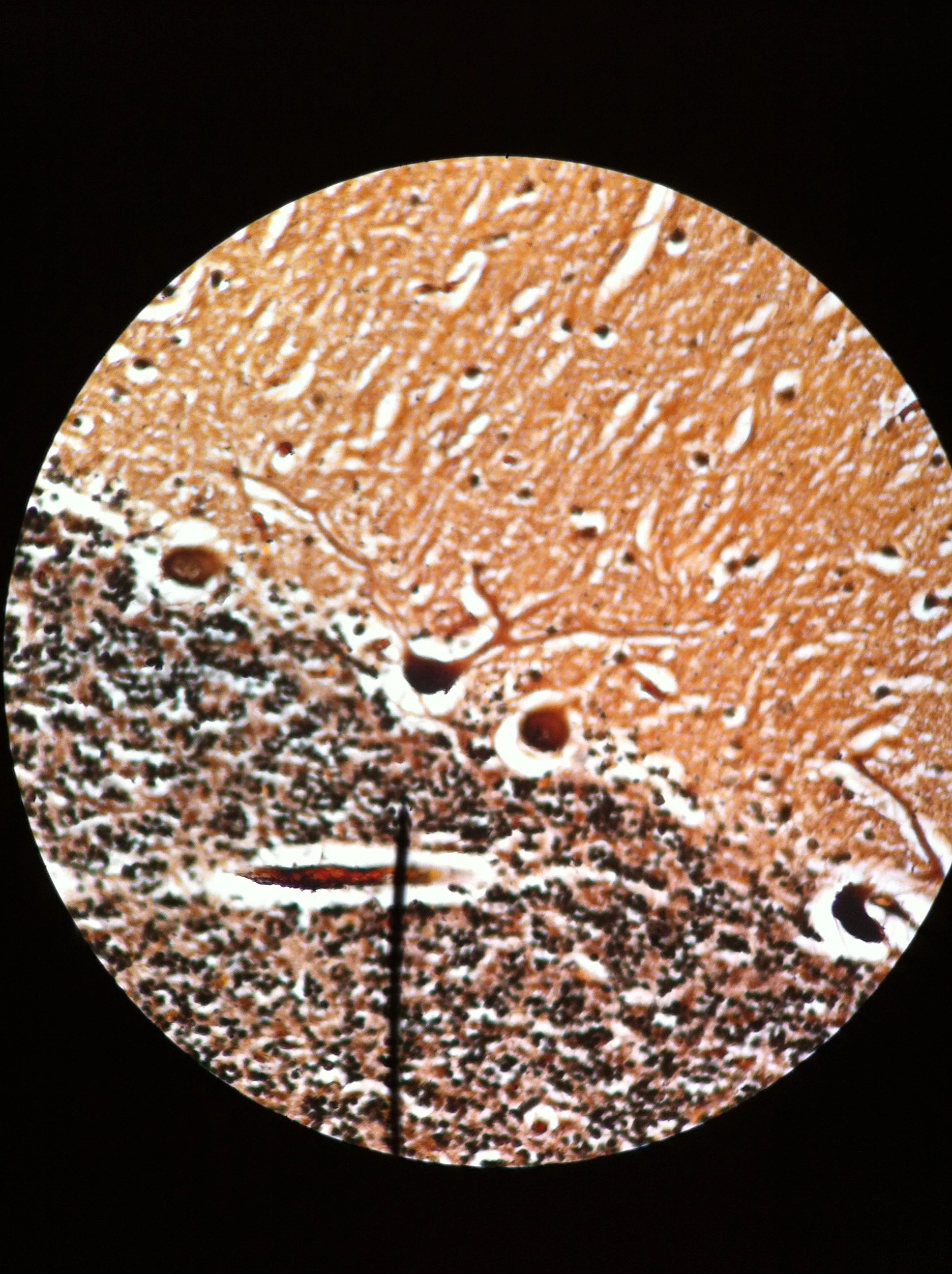 Purkenjie Cell