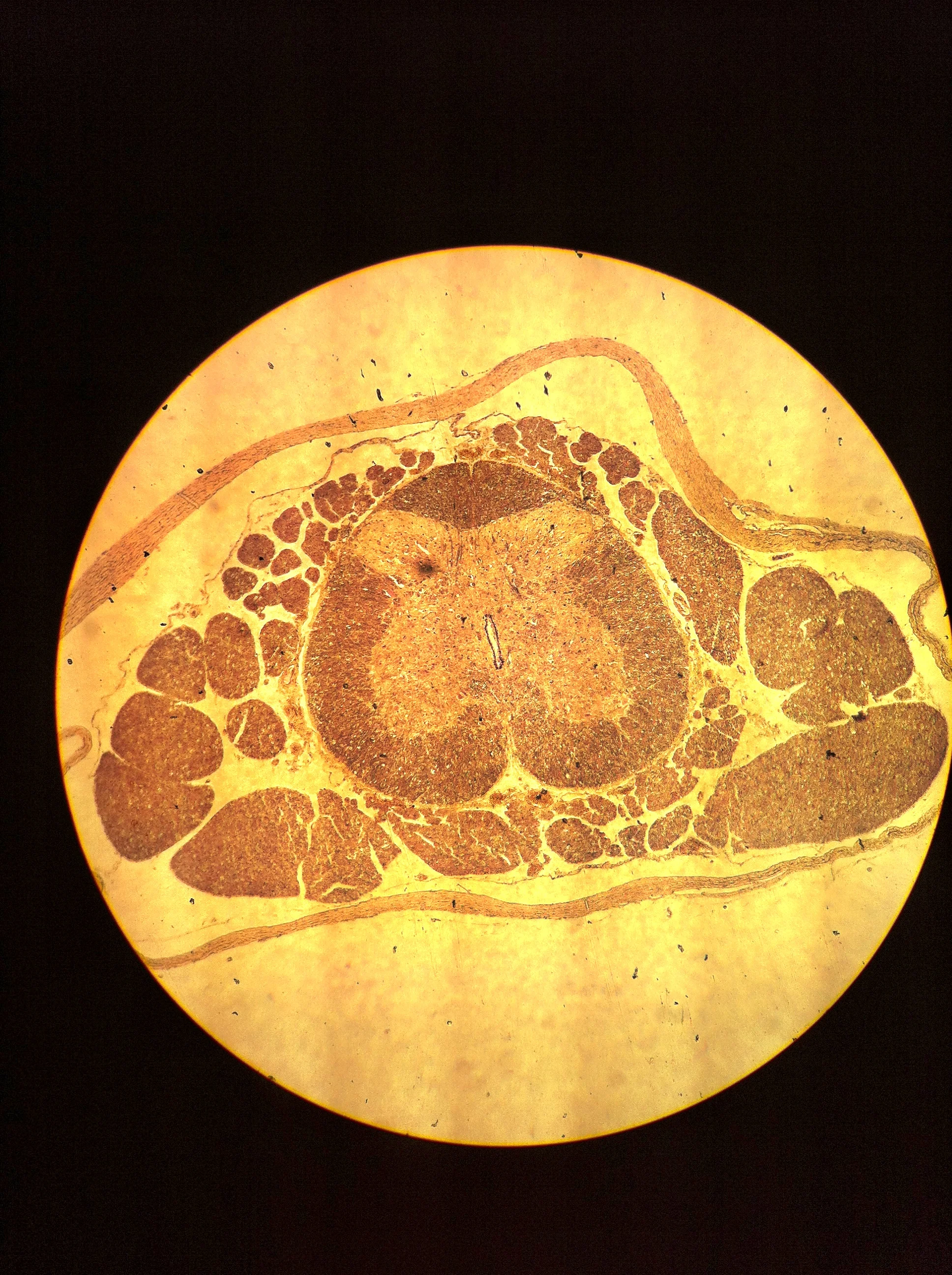 Sacral Spine 40X