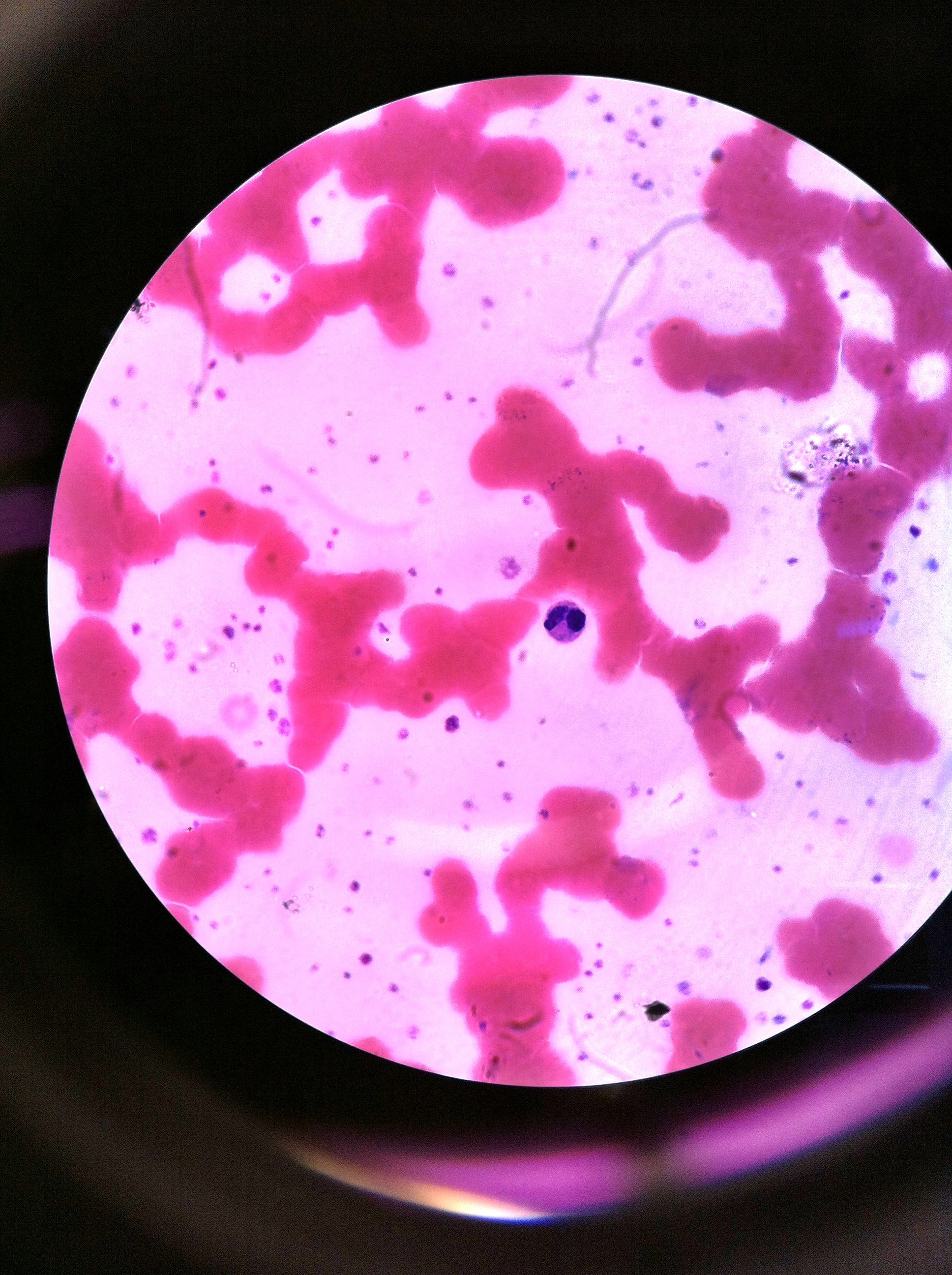 Eosinophils 1000X