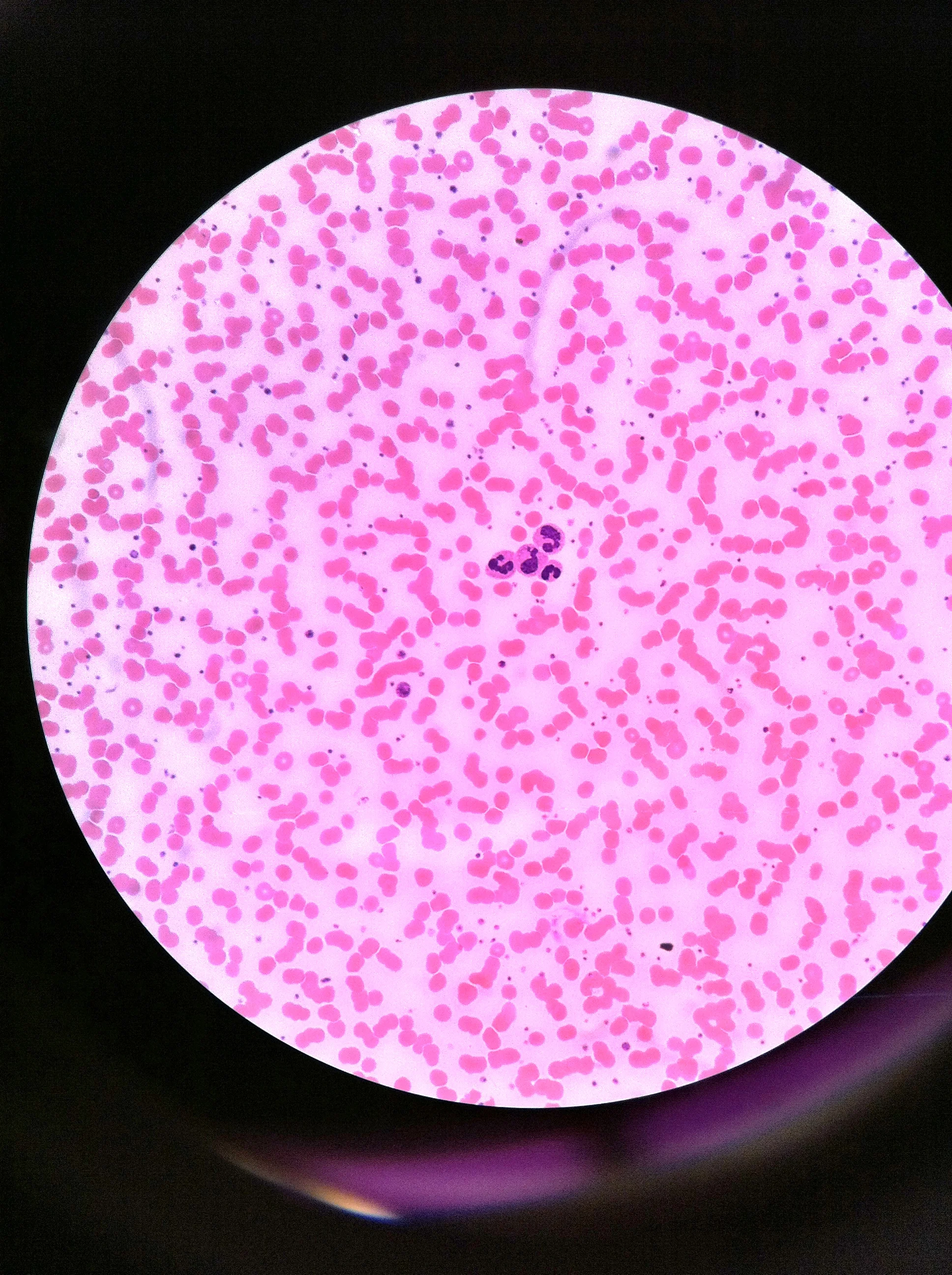 Eosinophils 400X