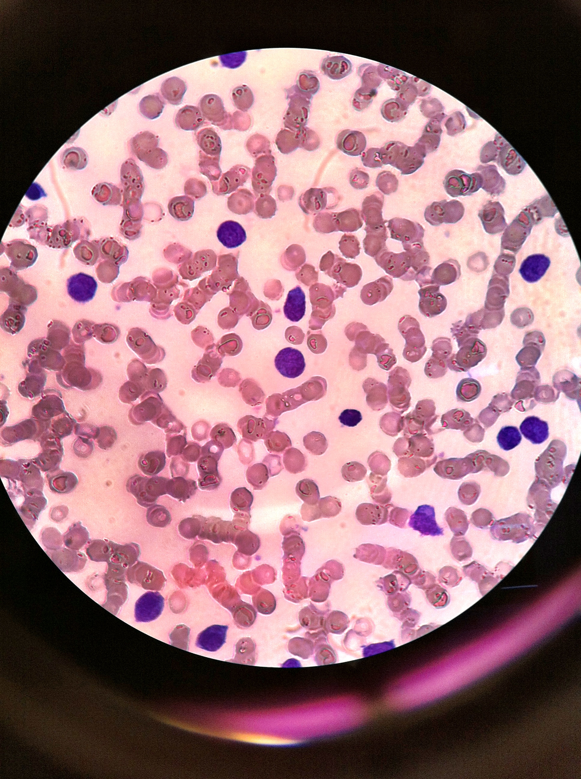 Lymphocytes 1000X