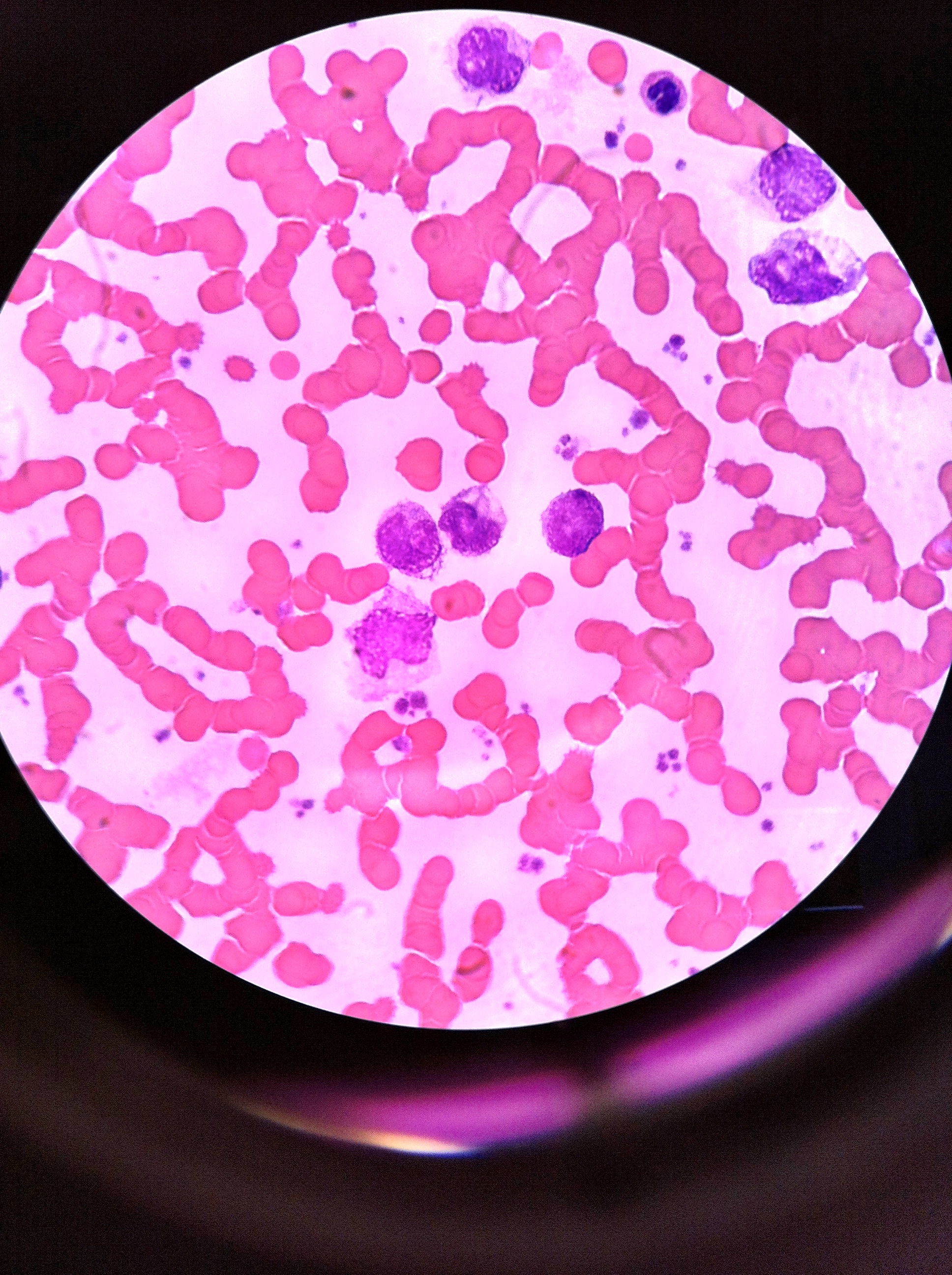 Monocytes 1000X