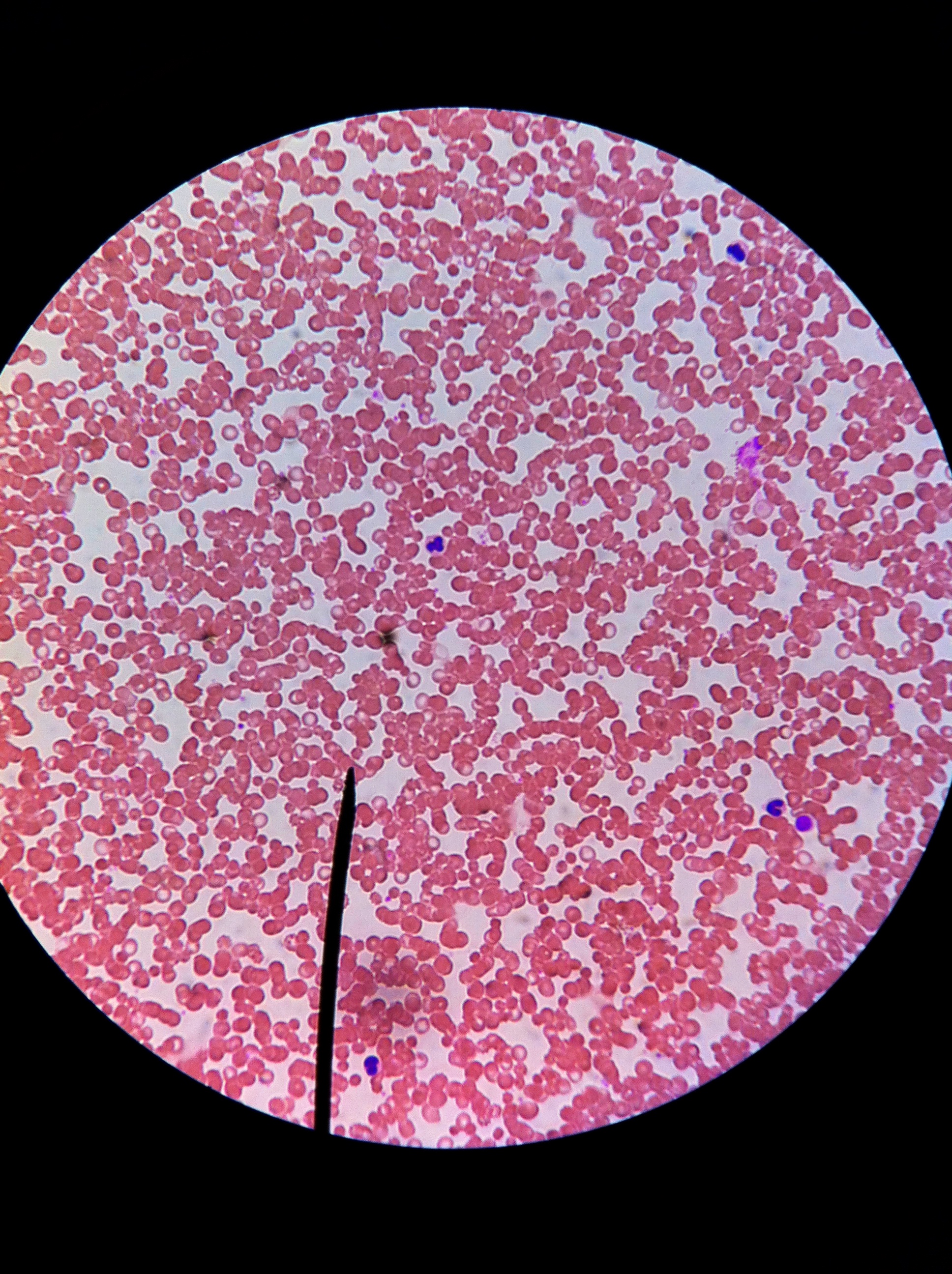 Erythrocytes (Wrights stain) 400X