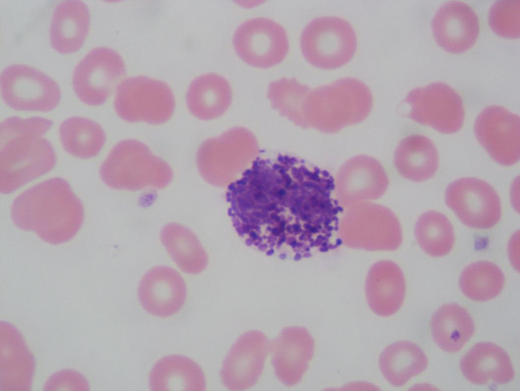 Basophil