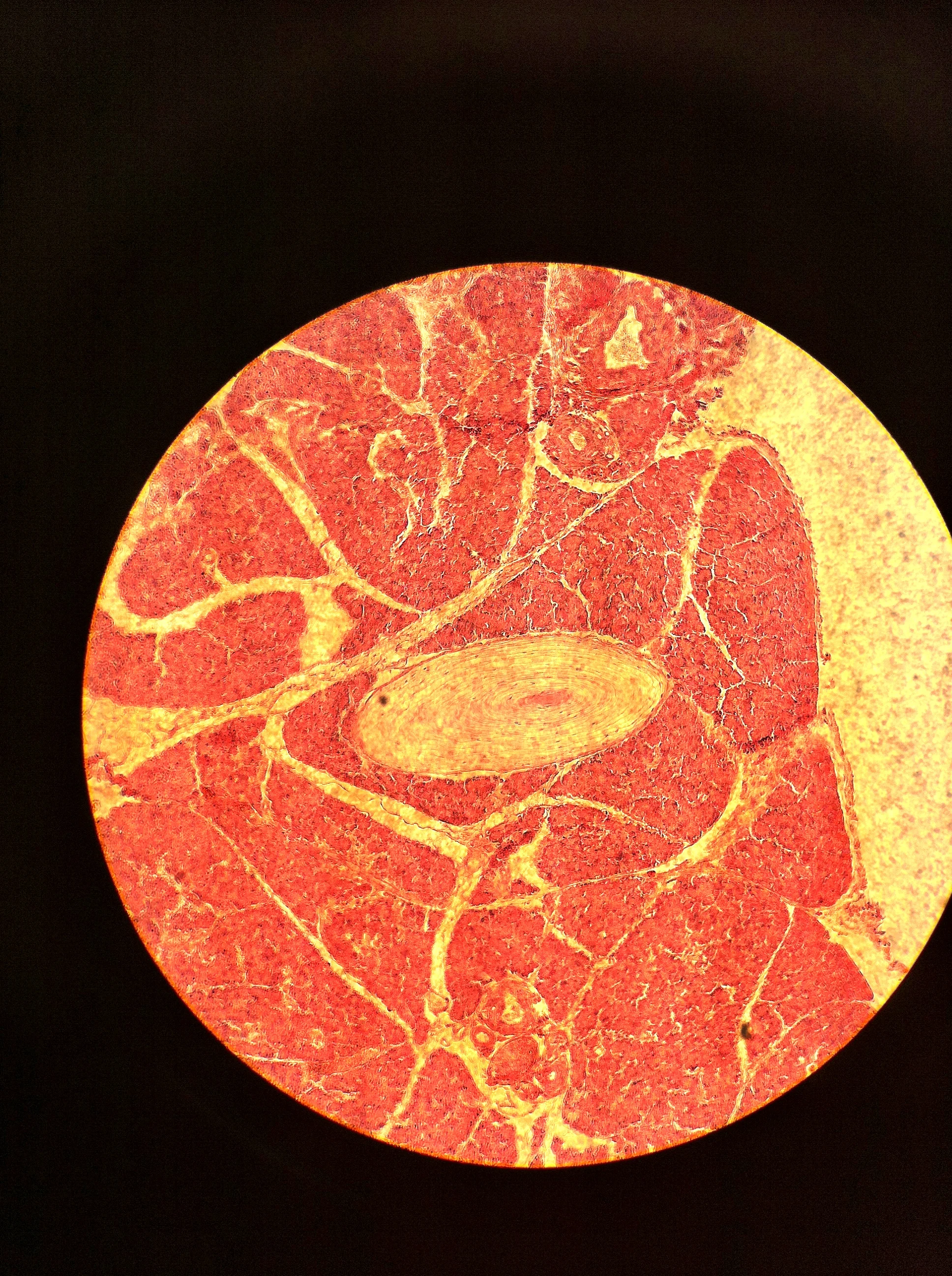 Pacinian Corpuscle 100X