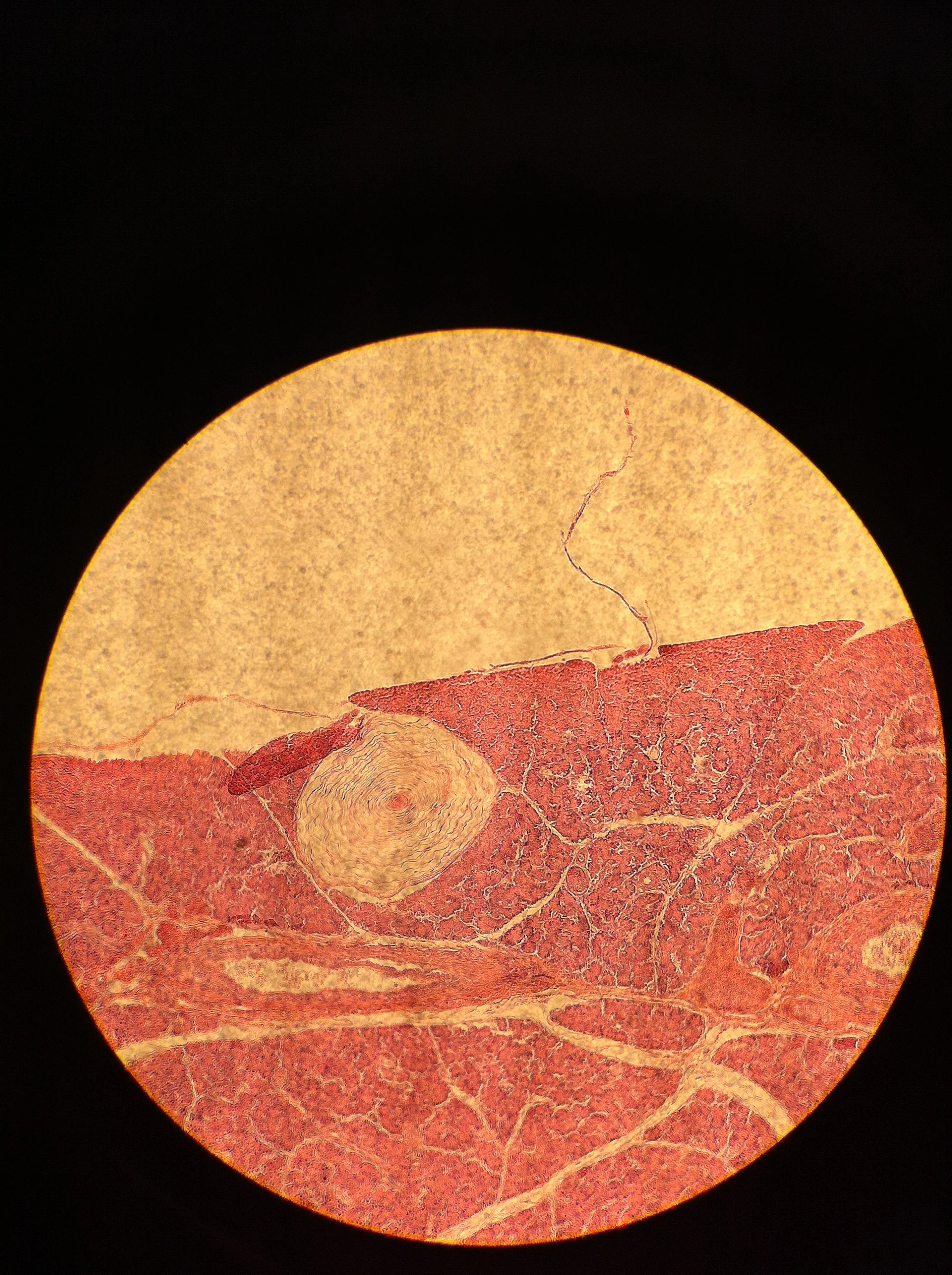 Pacinian Corpuscle 100X