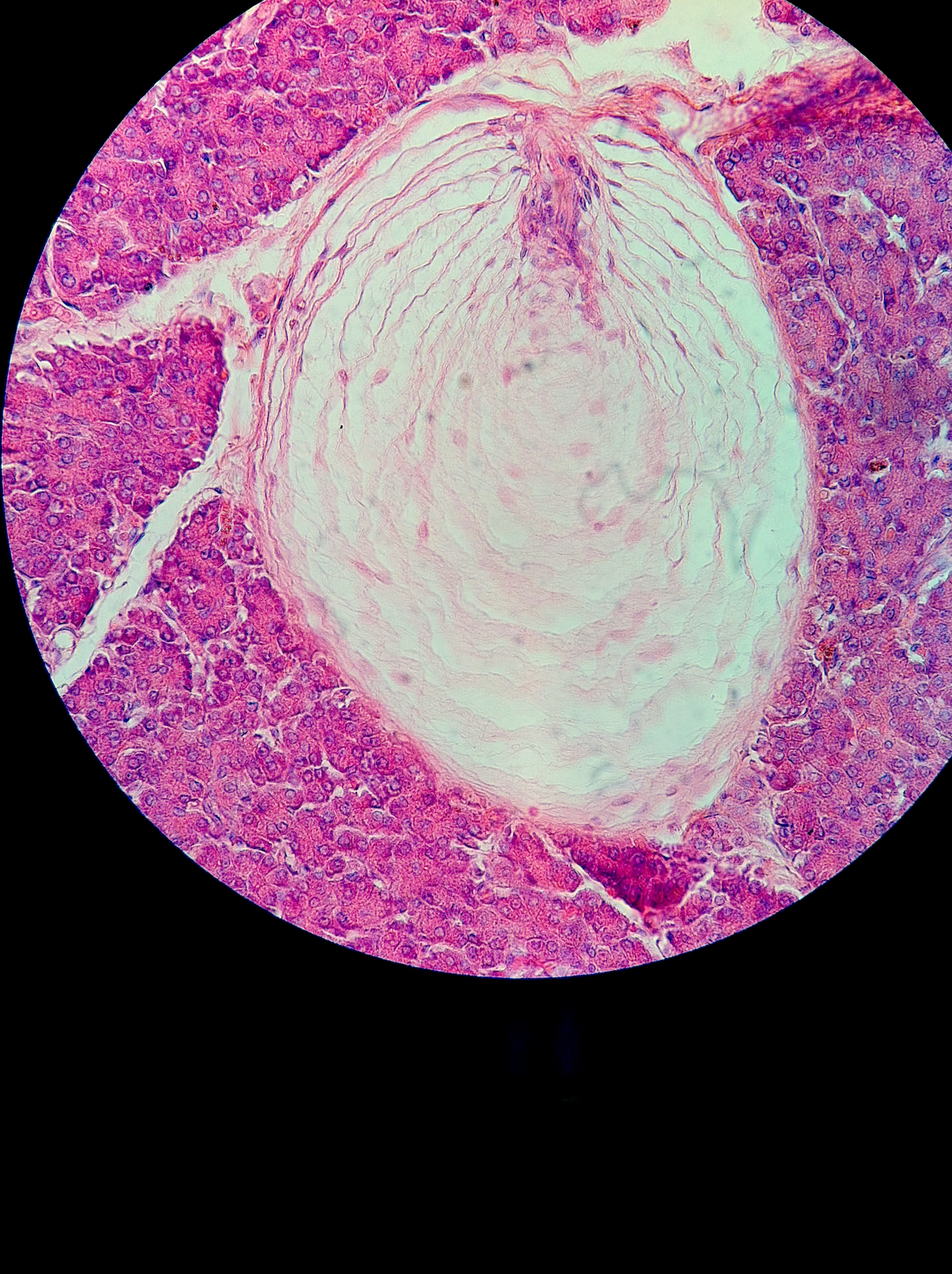 Pacinian Corpuscle 400X