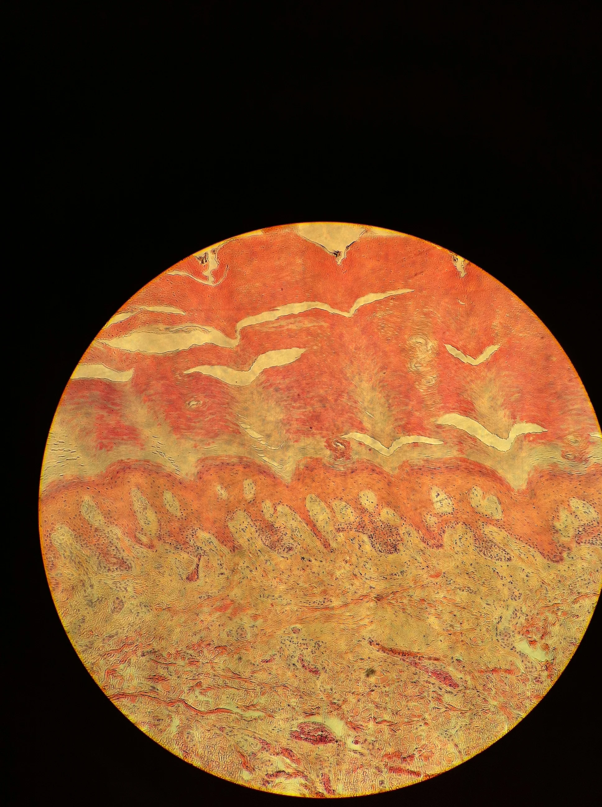 Meissners Corpuscle 100X