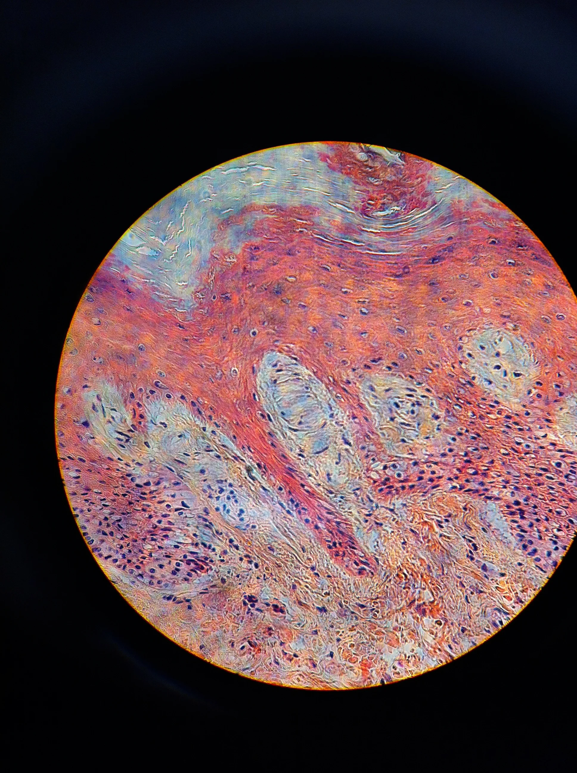 Meisners Corpuscle 400X