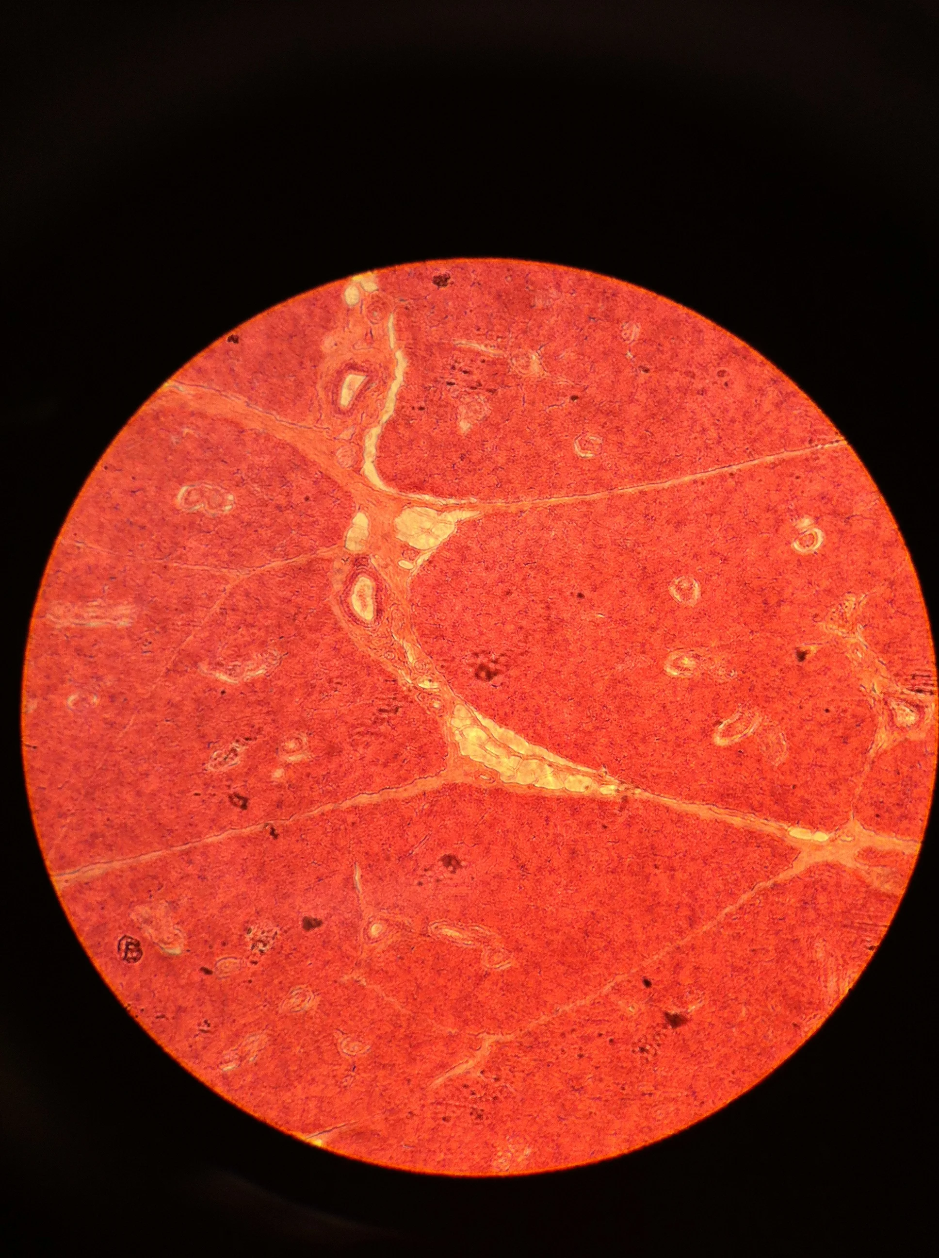 Parotid Gland 100X