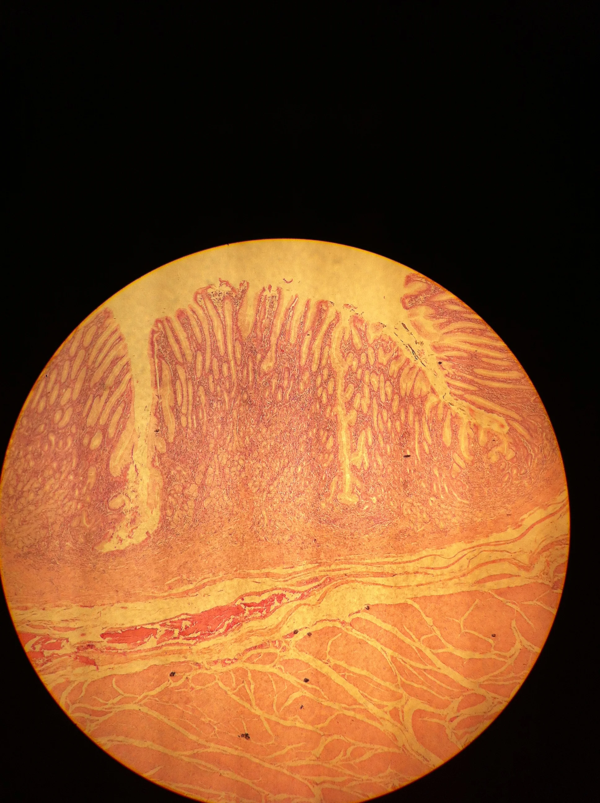 Pyloric Region 40X