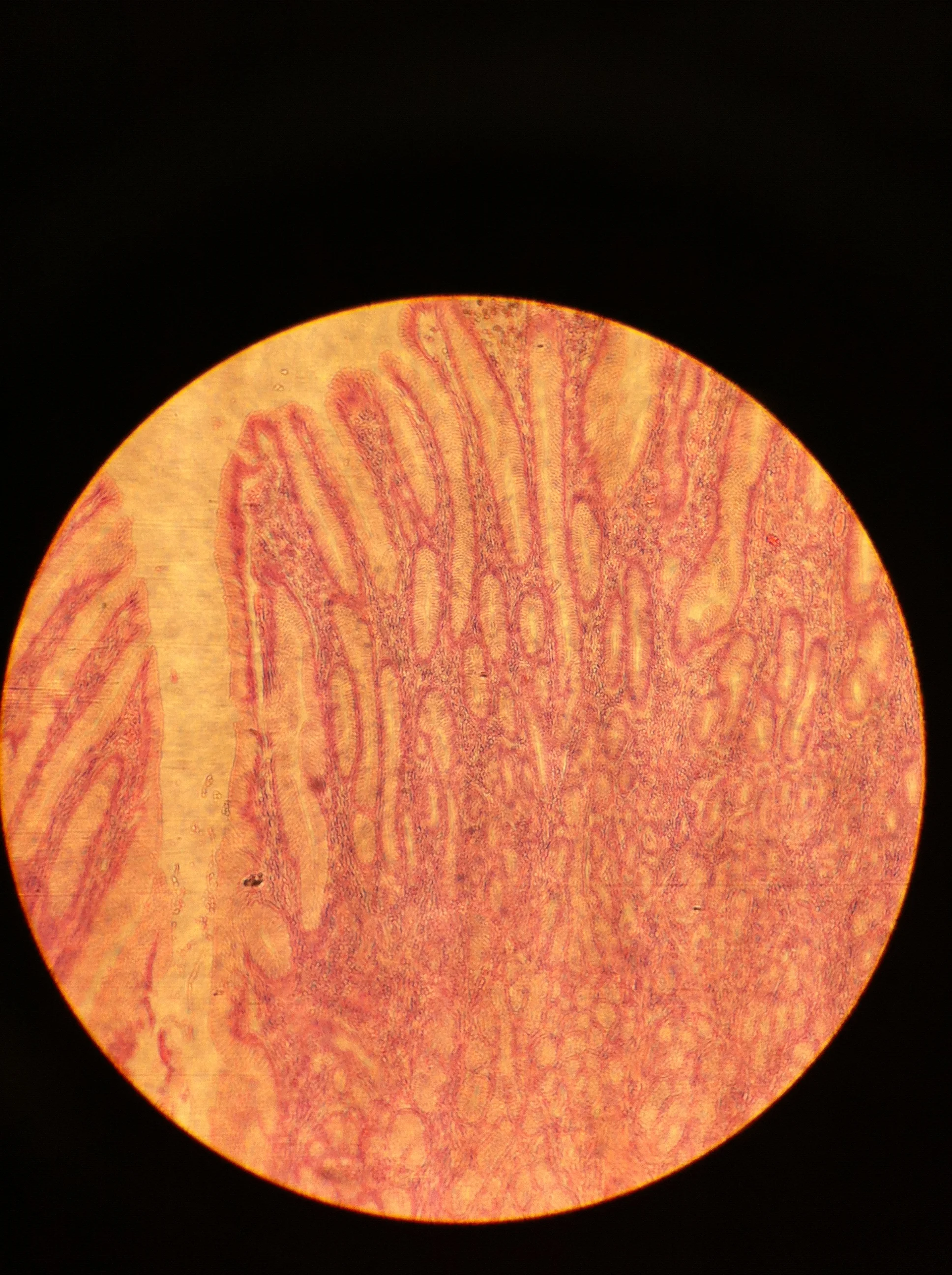 Pyloric Region 100X