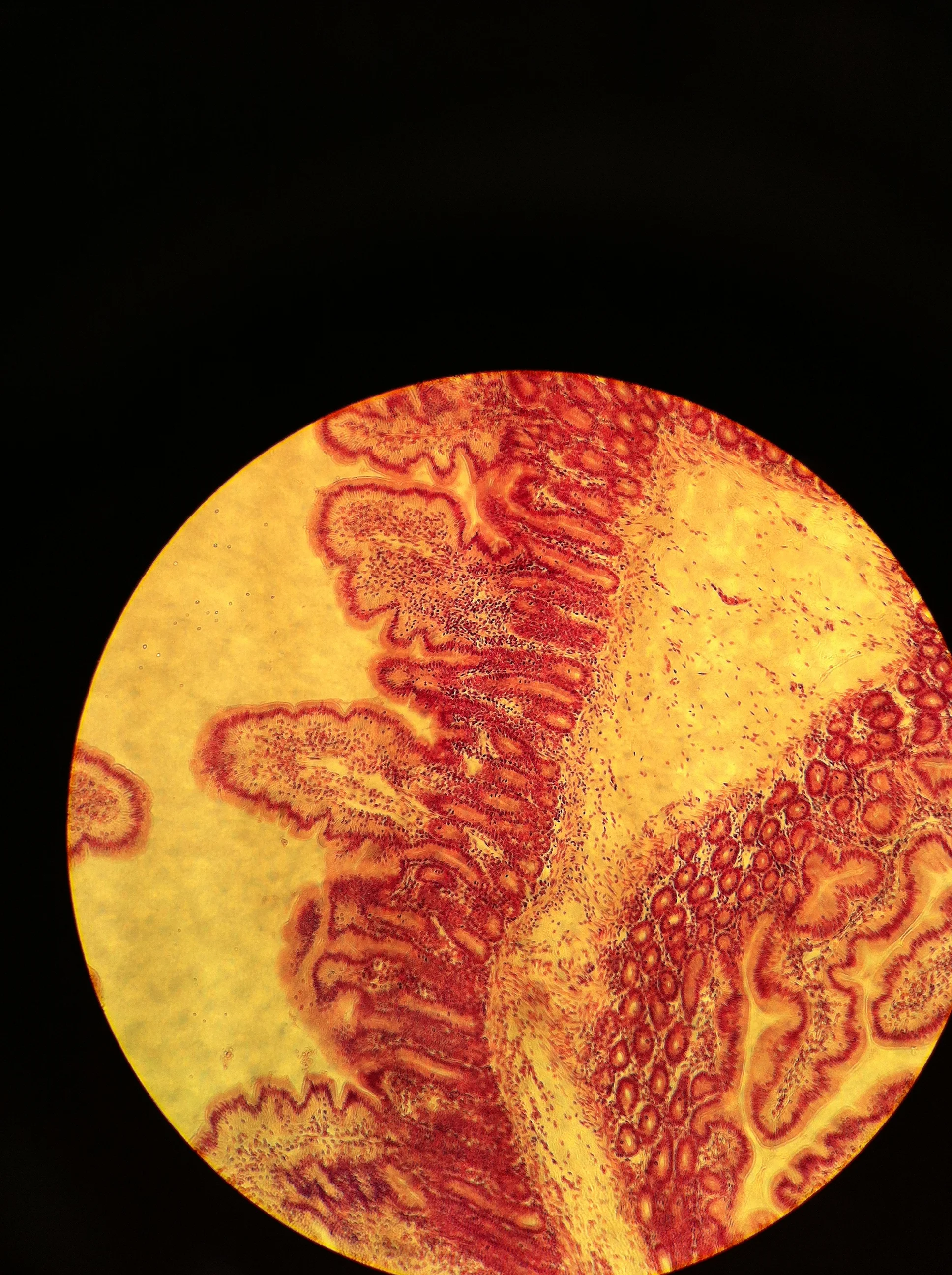 Jejunum 40X