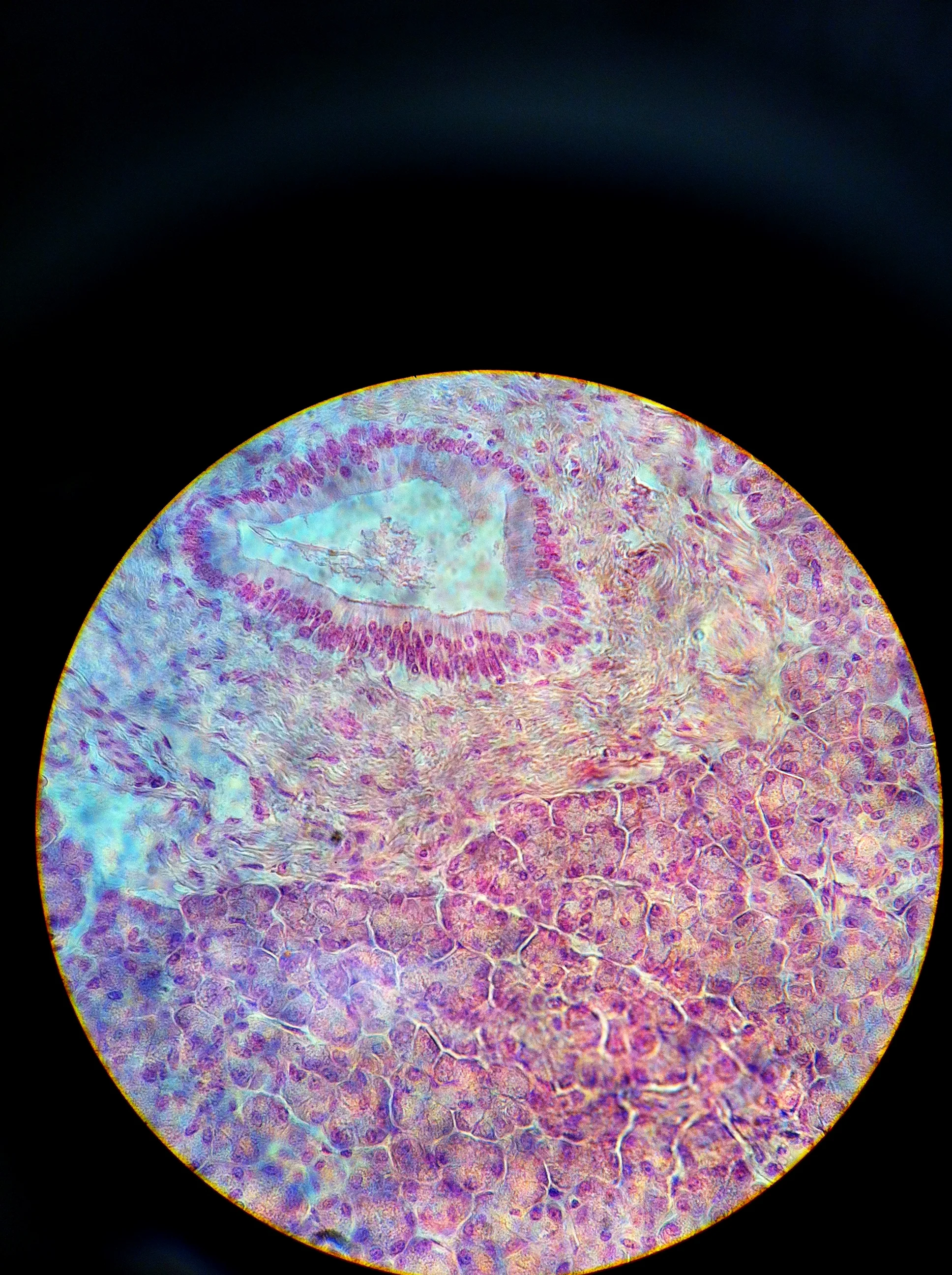 Pancreatic Duct 400X