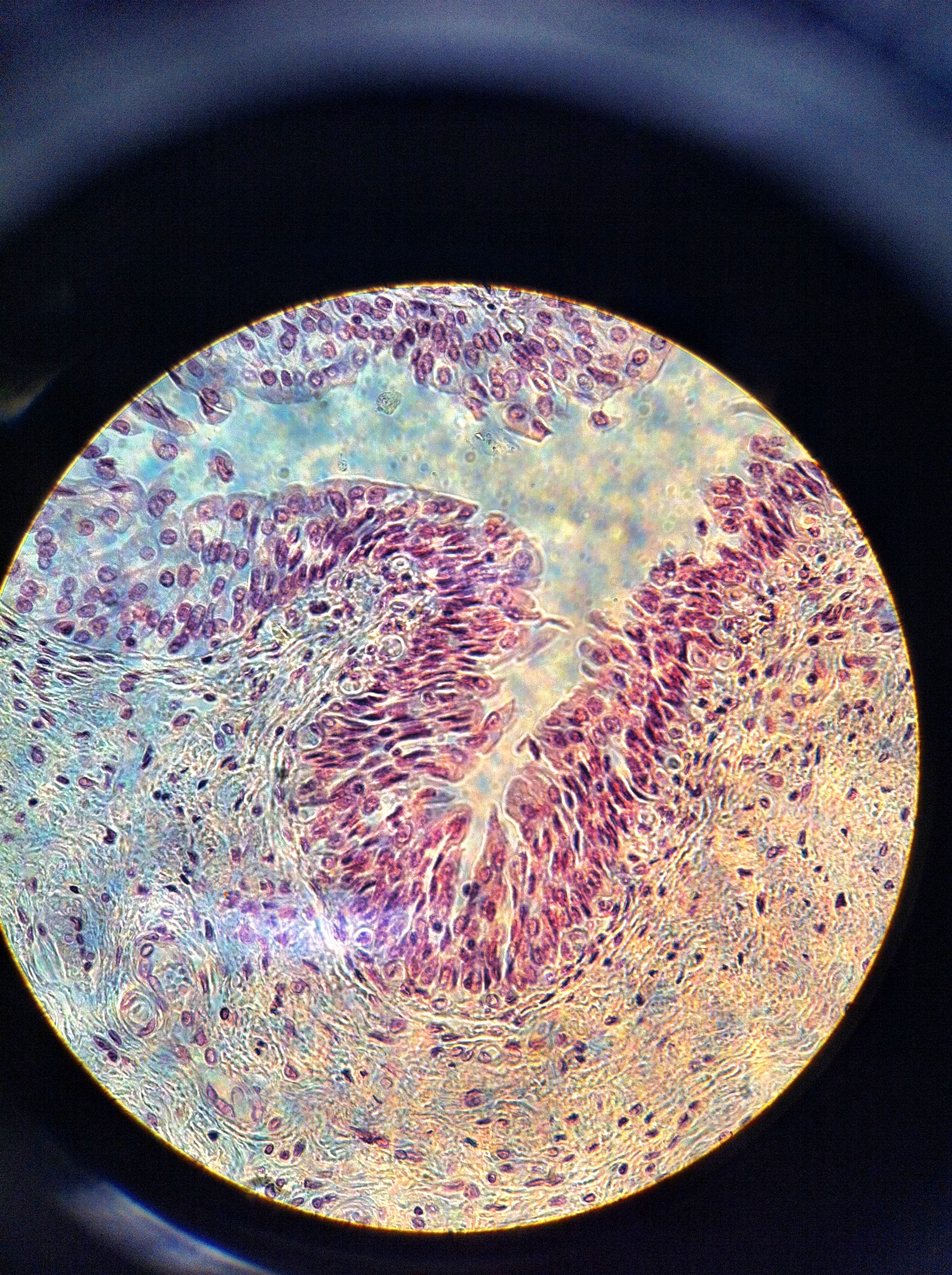 Ureter 400X