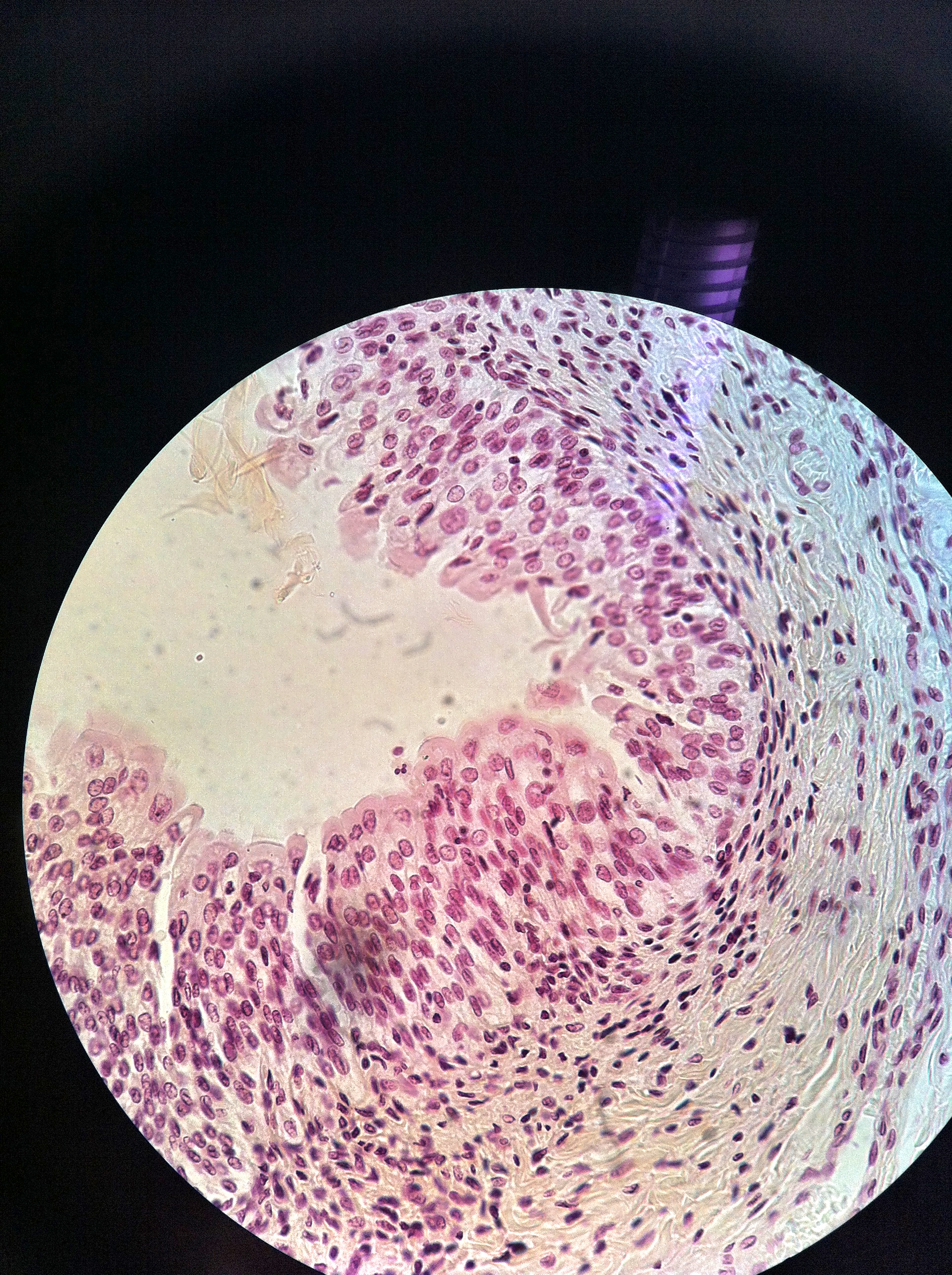 Bladder (transitional epithelium) 400X