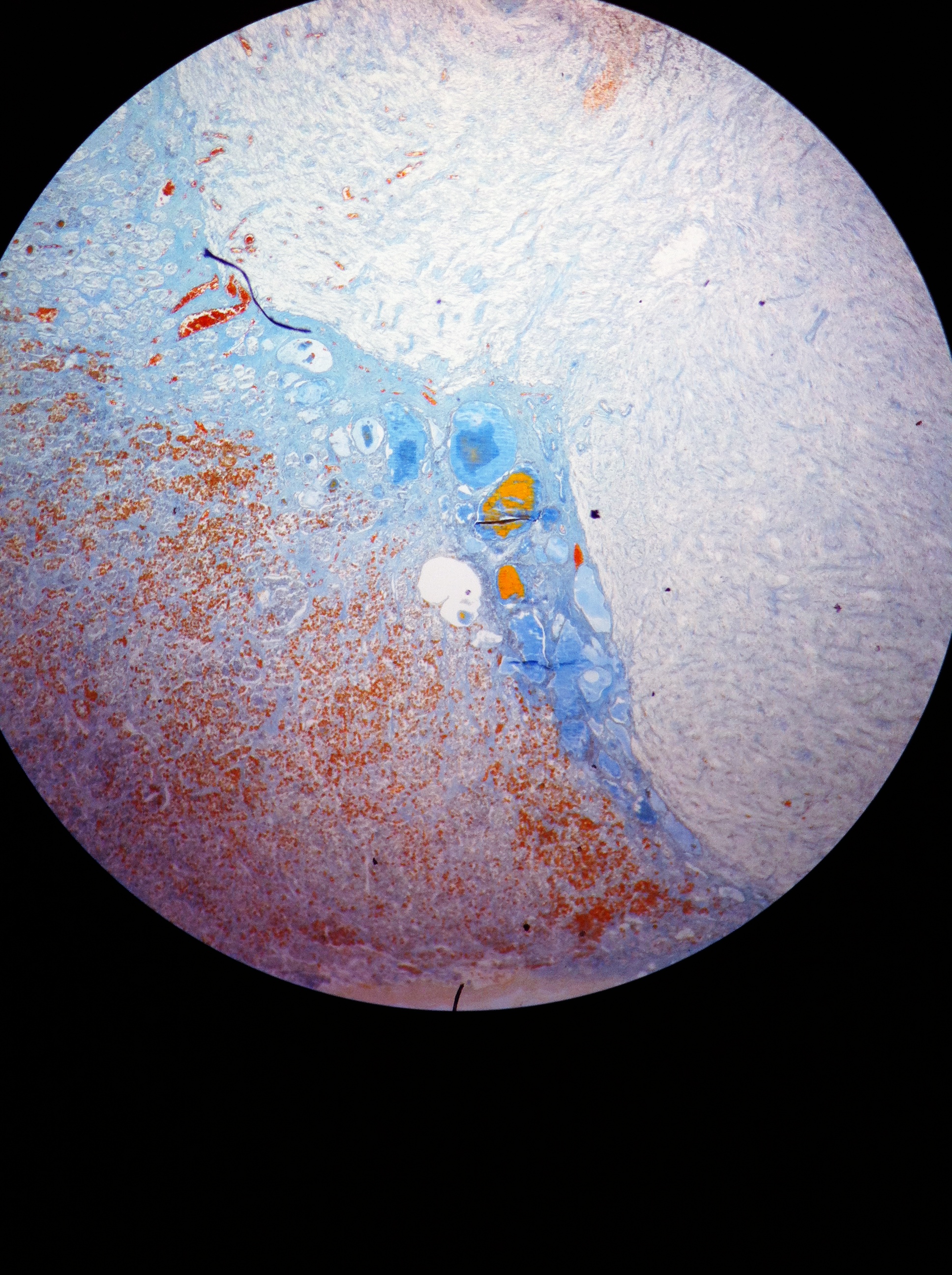 Pituitary 40X