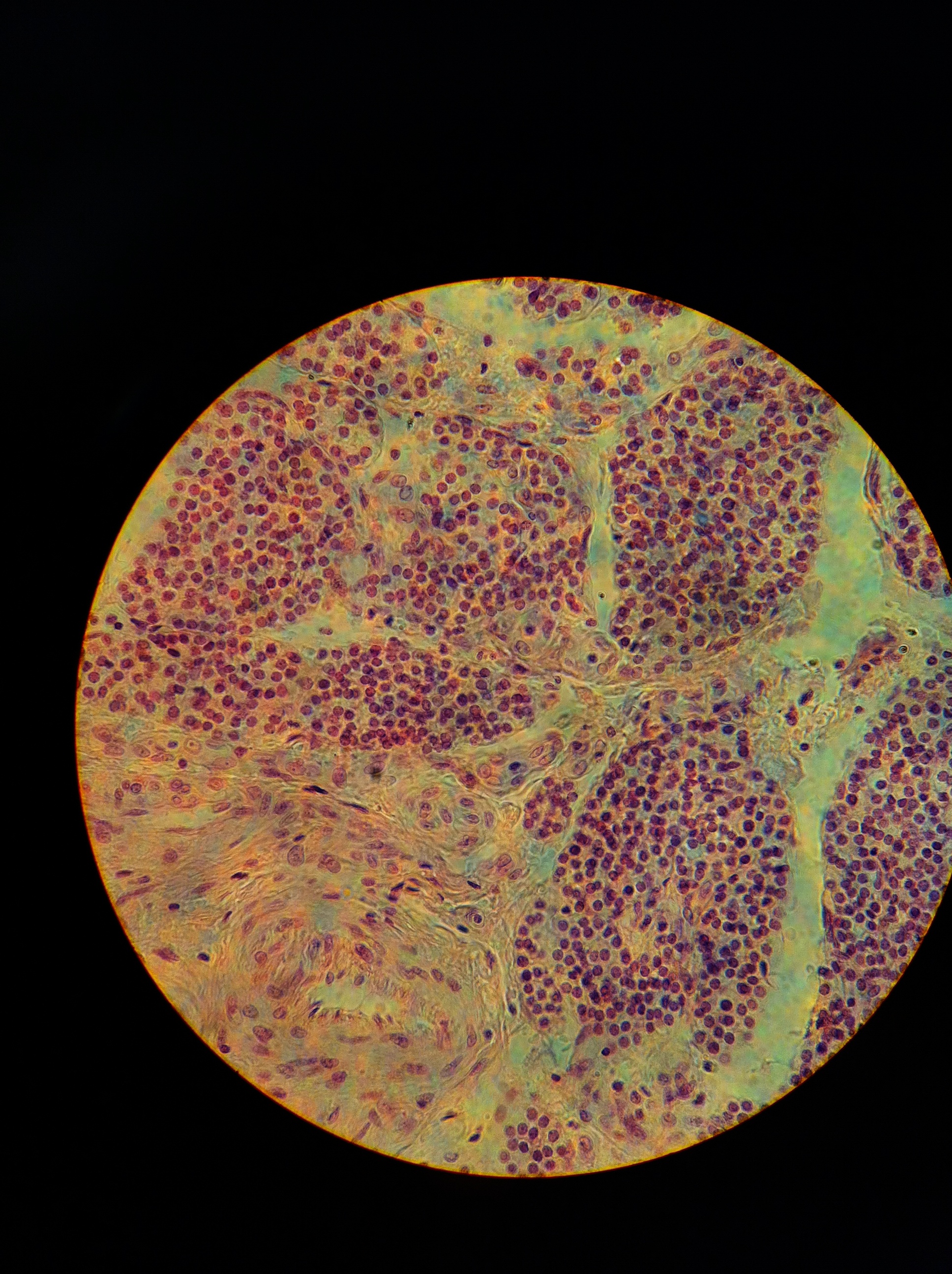 Parathyroid 400X