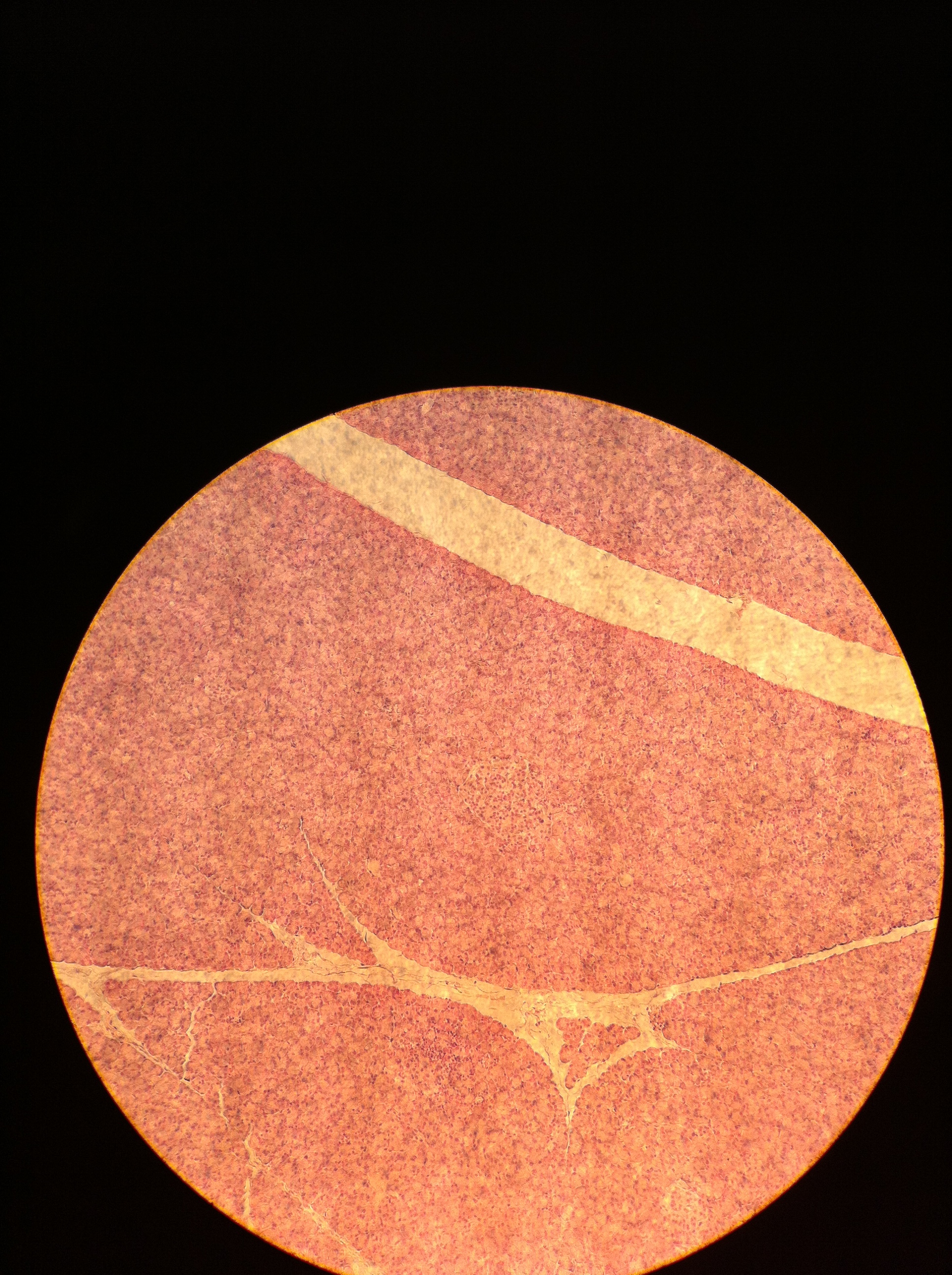 Pancreatic Islet 100X