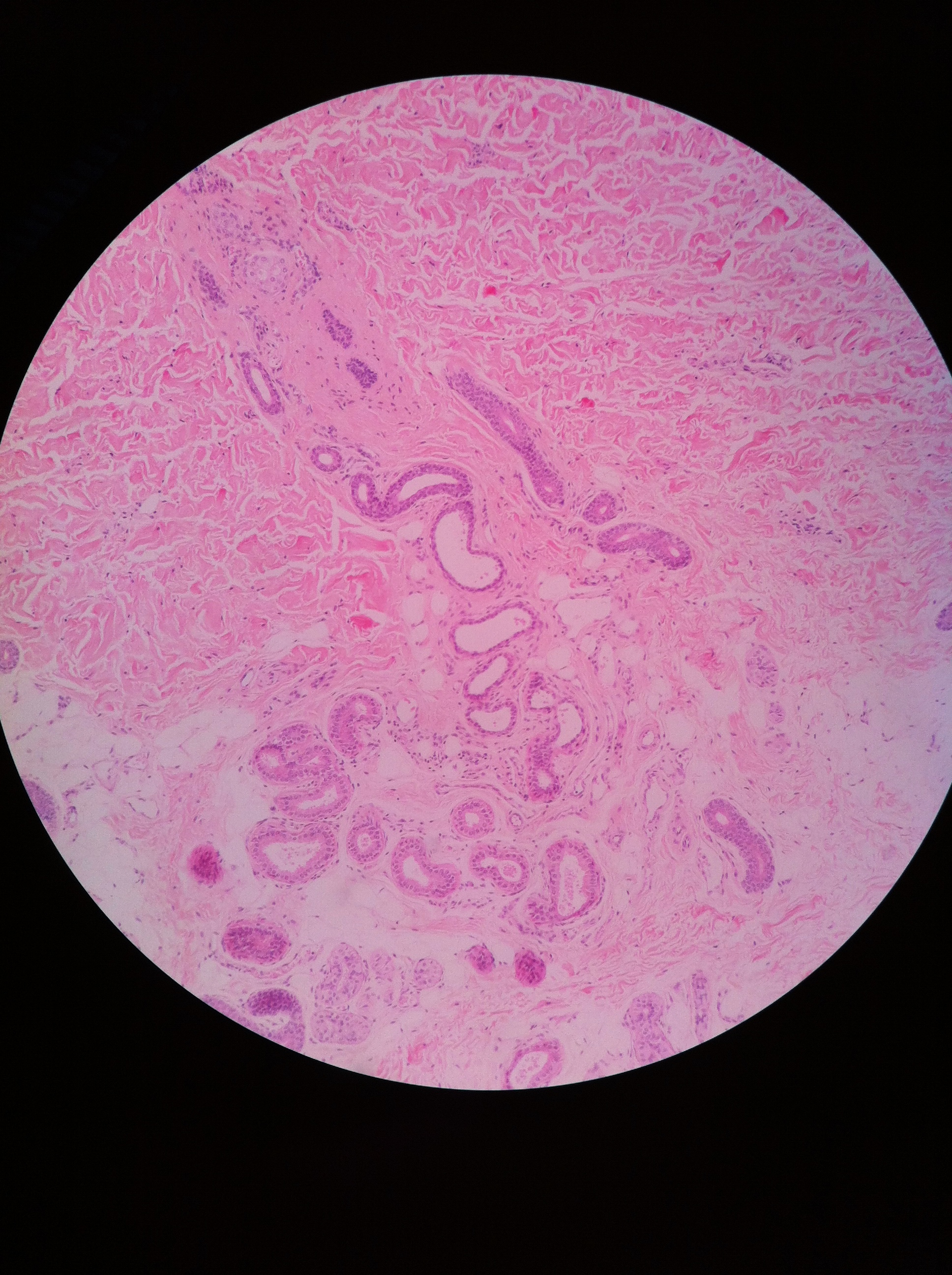 Apocrine Glands, Total Mag: 100X