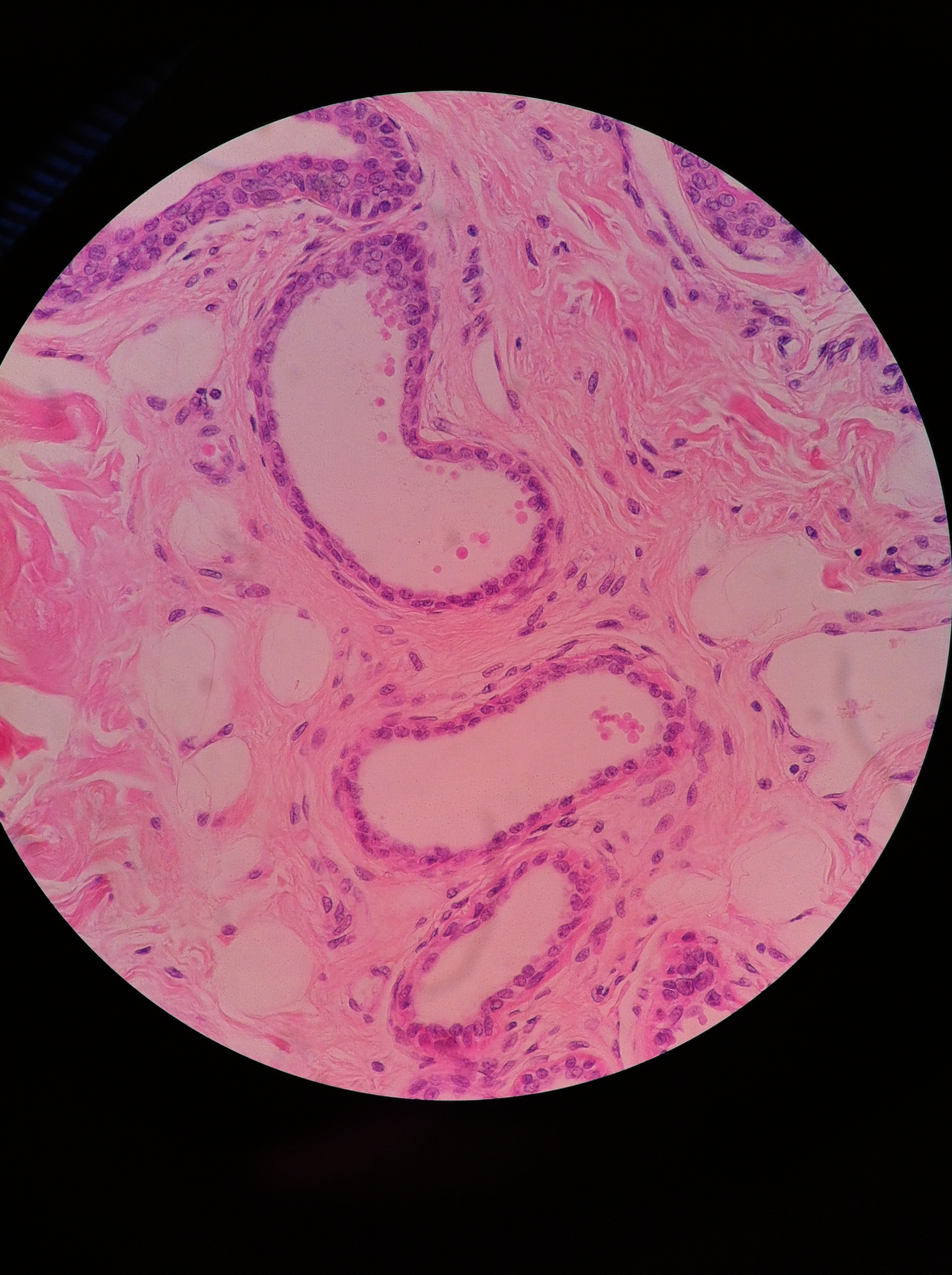 Apocrine Glands, Total Mag: 400X