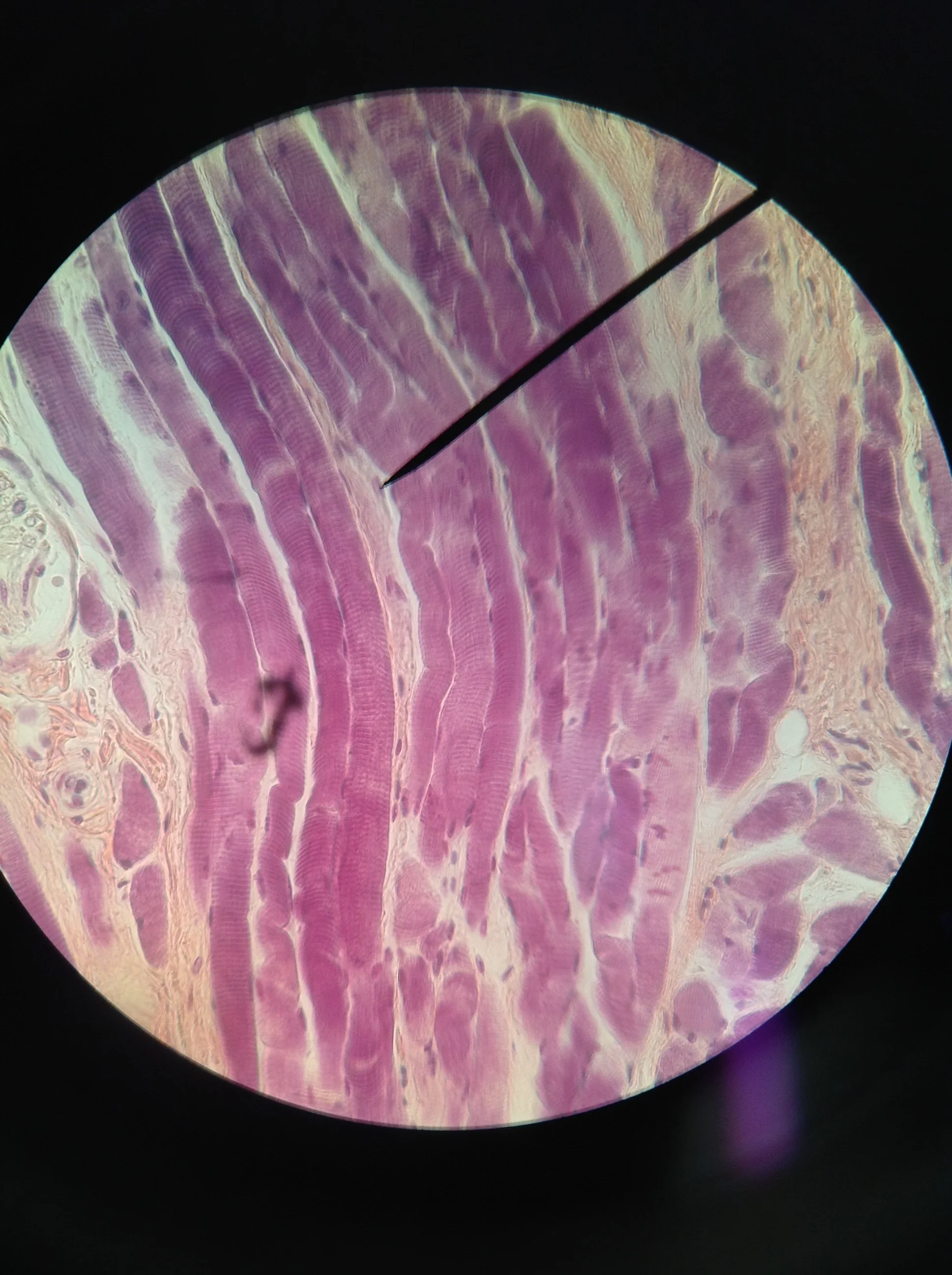 Skeletal Muscle  (ls) 400X