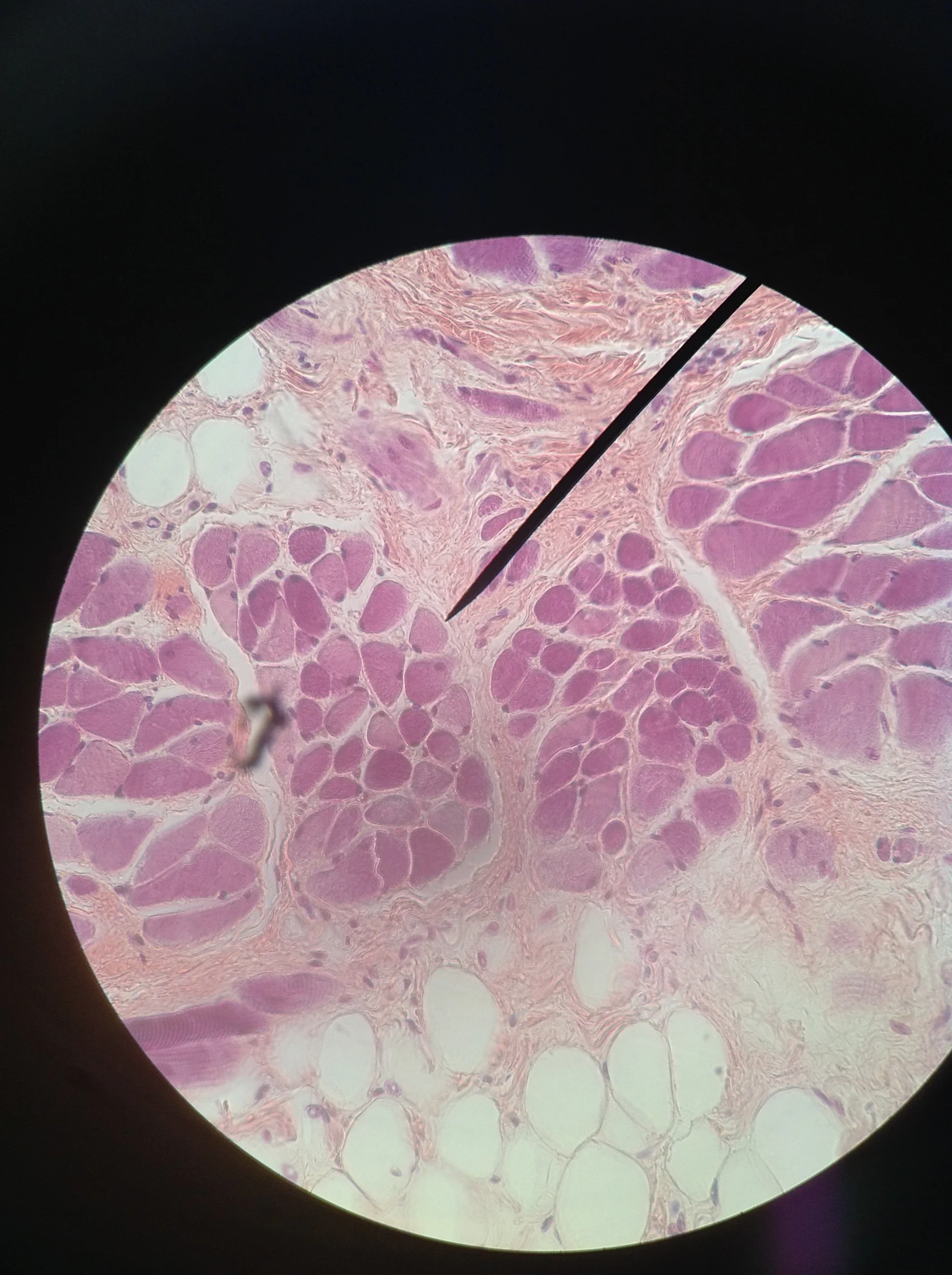 Skeletal Muscle (cs) 400X