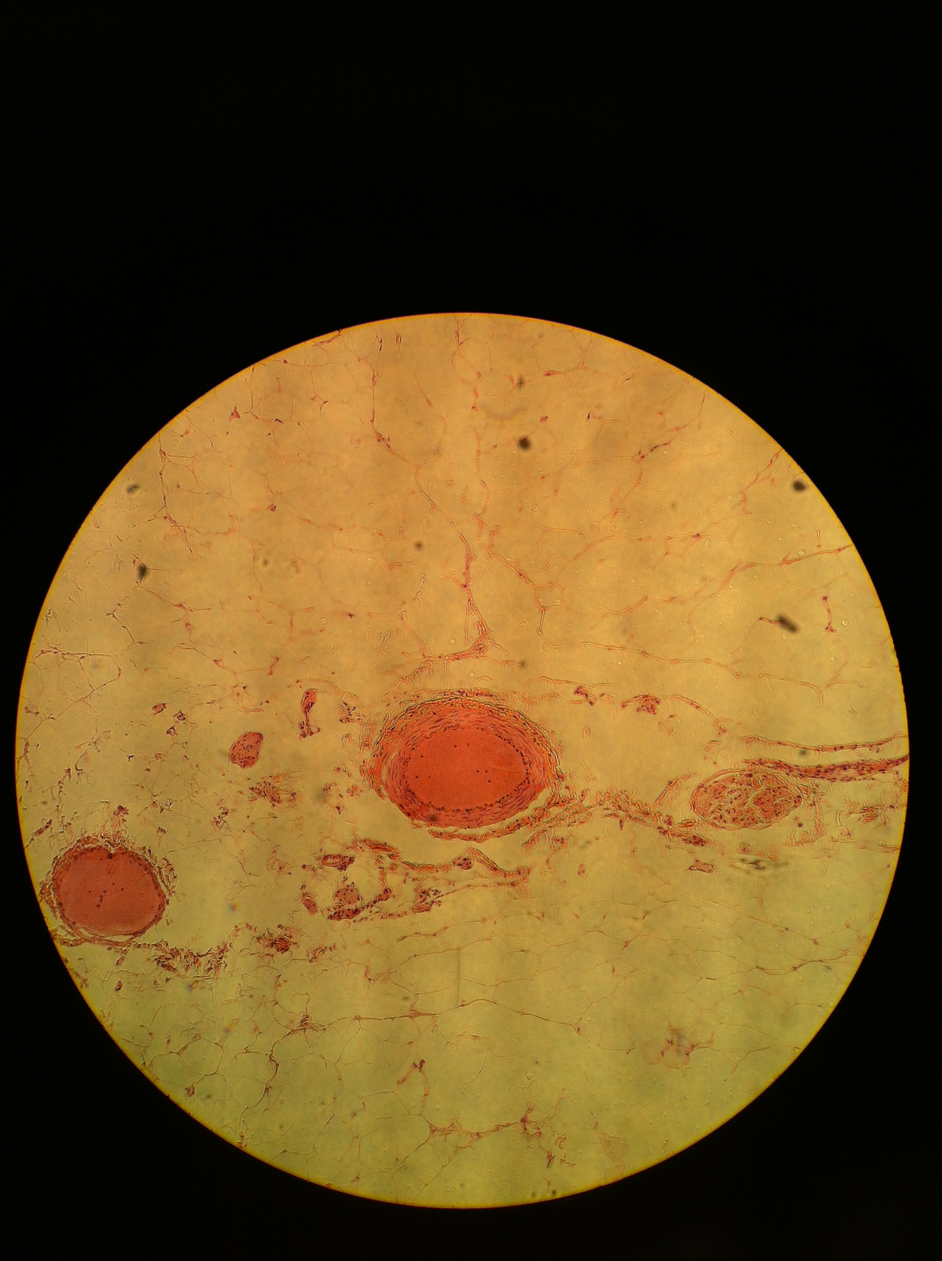 Arteriole 100X