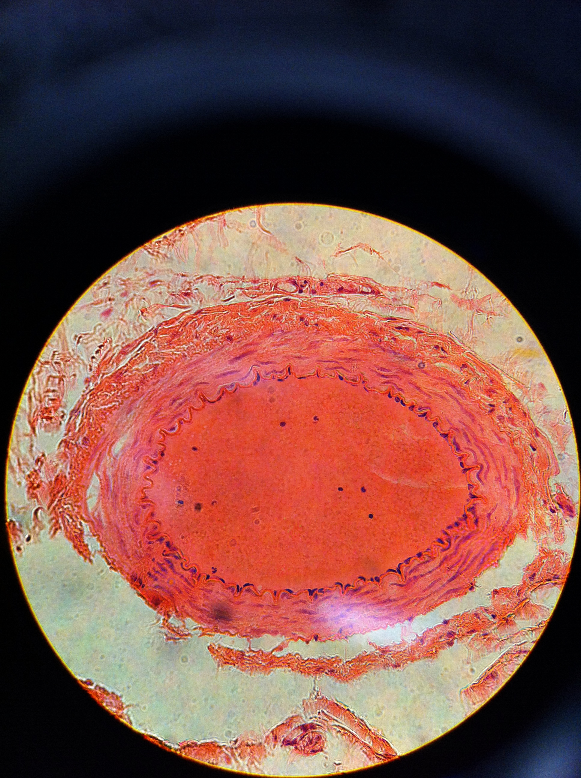 Arteriole 400X