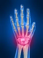 wrist_pain small.jpg