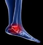 ankle pain 1.jpg