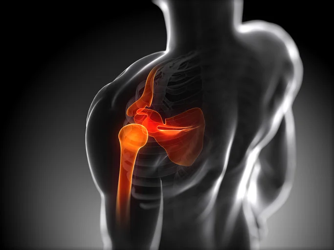 houstonsportsmedicine-shoulder-injury-treatment.jpg