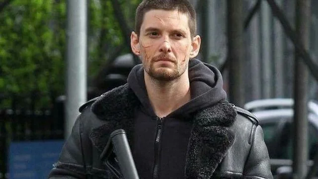 Does this guy’s face look like it was smashed into a thousand pieces?