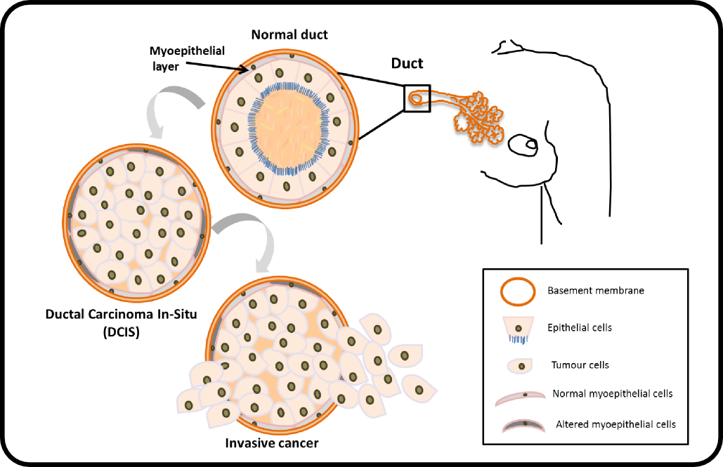 Breast Cancer Cellular And Molecular Biomechanics Laboratory