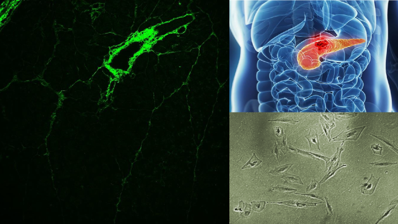 Clockwise from top right: location of pancreas; enhanced brightfield image of pancreatic stellate cells; two-photon second harmonic image of a normal pancreatic tissue showing collagen distribution around the pancreatic ducts.