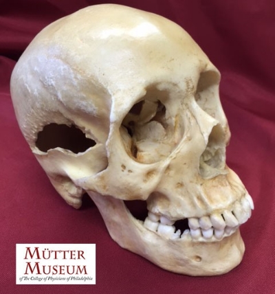 muttermuseum.jpg