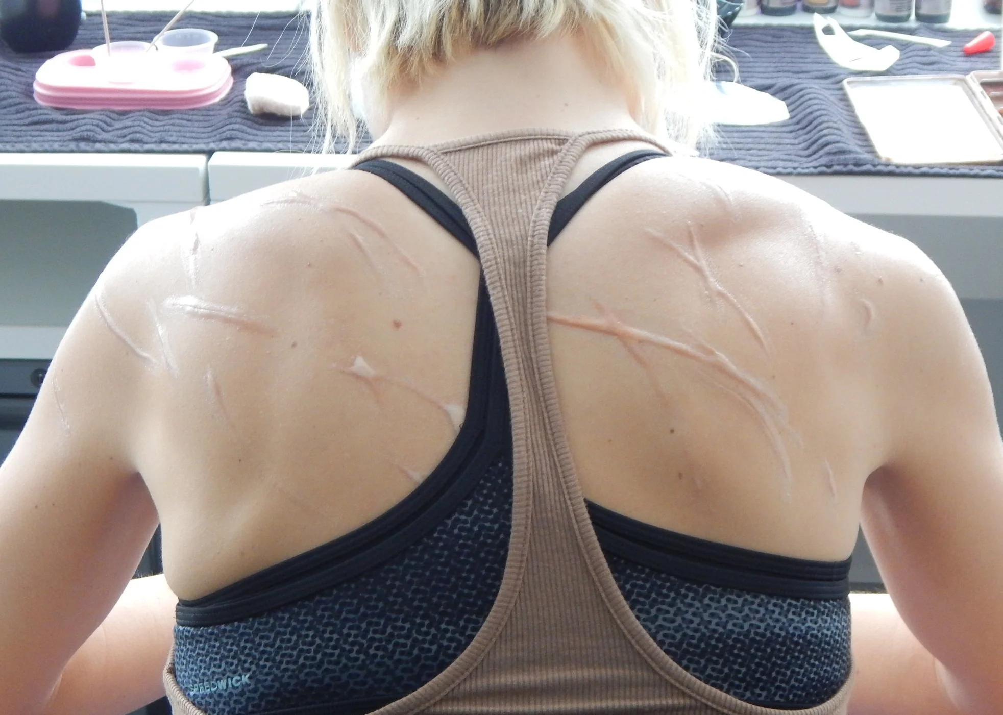  Prosthetics created by Yellow Moth makeup 