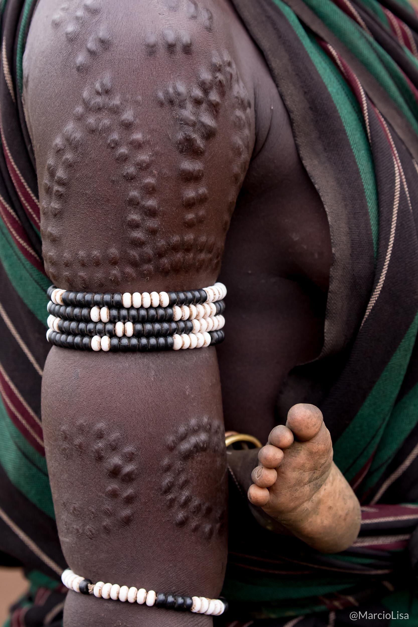 Escarificações de pele, Povo Mursi na Etiópia