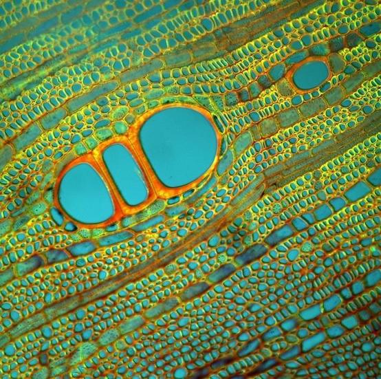 Diospyrus Lotus, by Fernan Federici. Source: http://www.featherofme.com/fernan-federici-microscopic-photographs-of-plants/