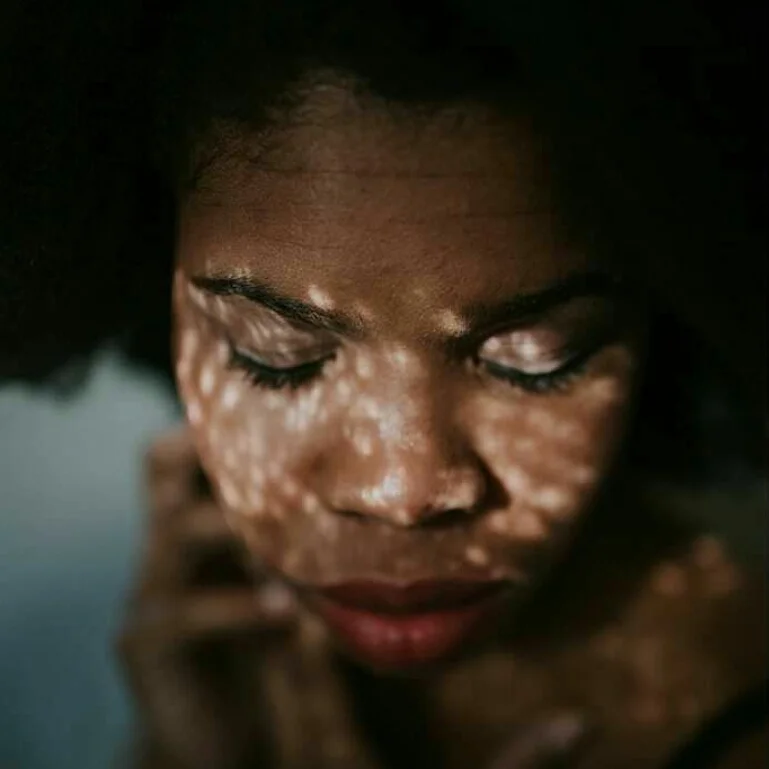 Black Girl Do You | Musings of a Black Female Adoptee 
