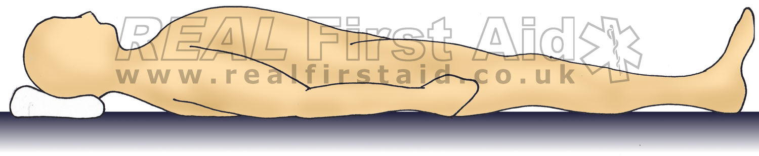 Recumbent Example Casualty Positioning — REAL First Aid