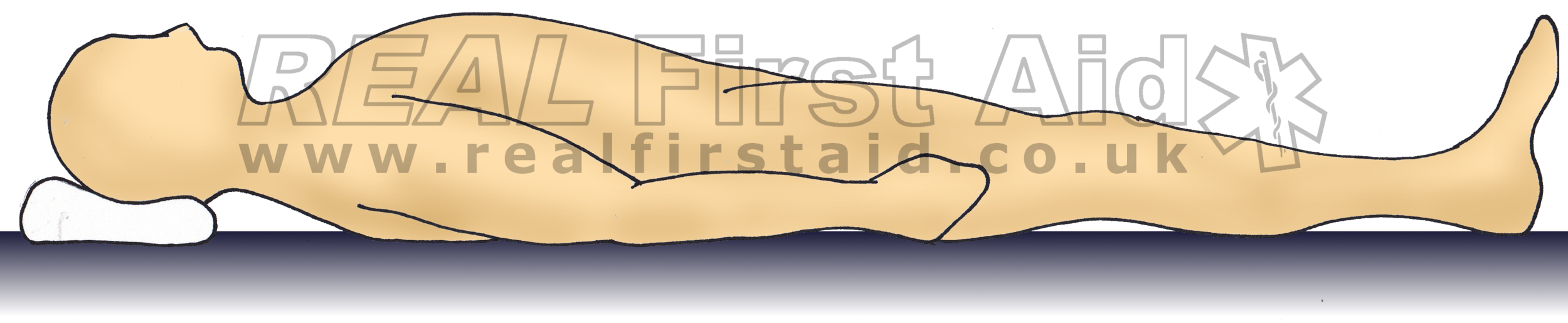 Recumbent Example Casualty Positioning — REAL First Aid