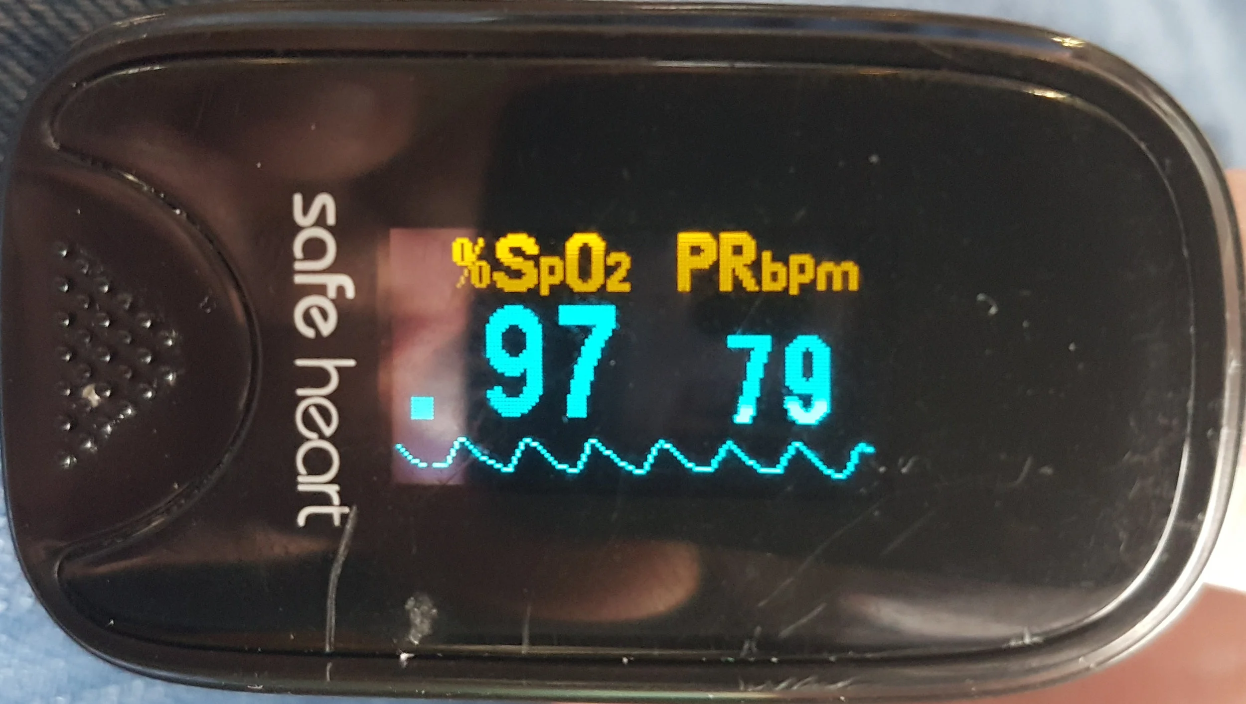 Strong pulse pressure but without an obvious dicrotic notch indicating good pulse pressure and perfusion but increased arterial resistance.