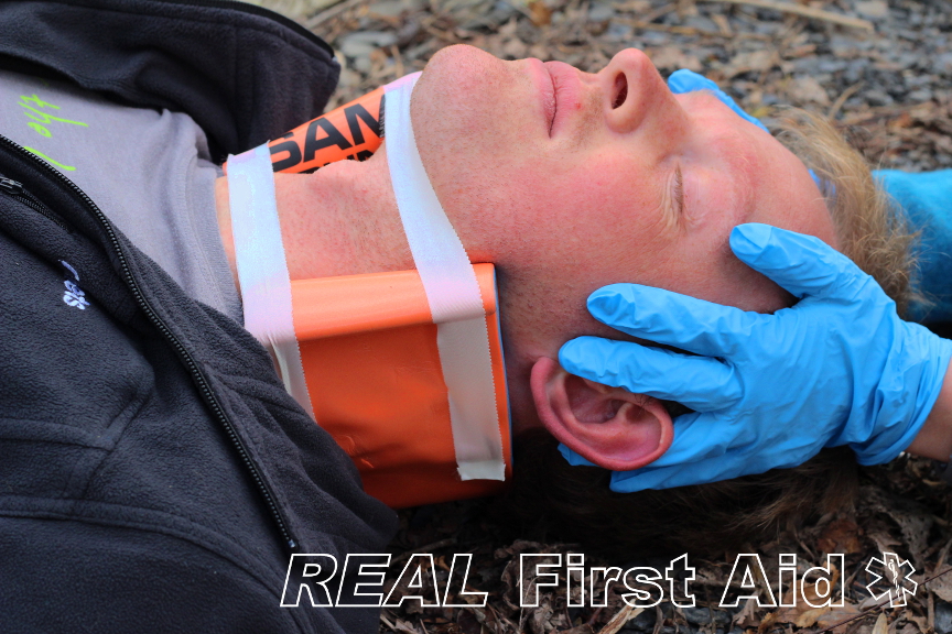 Sam Splints — Real First Aid